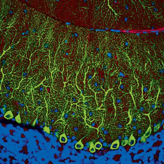 purkinje cells