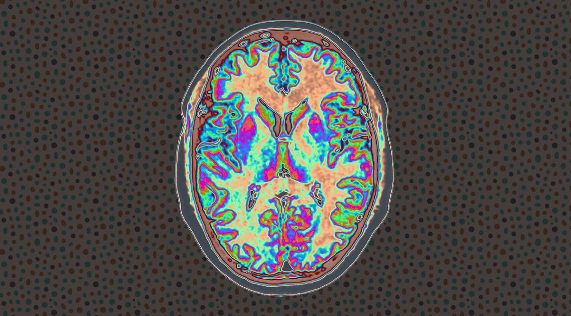 Teenage Brain Development Study Forecasts Drinking Behavior By Sex