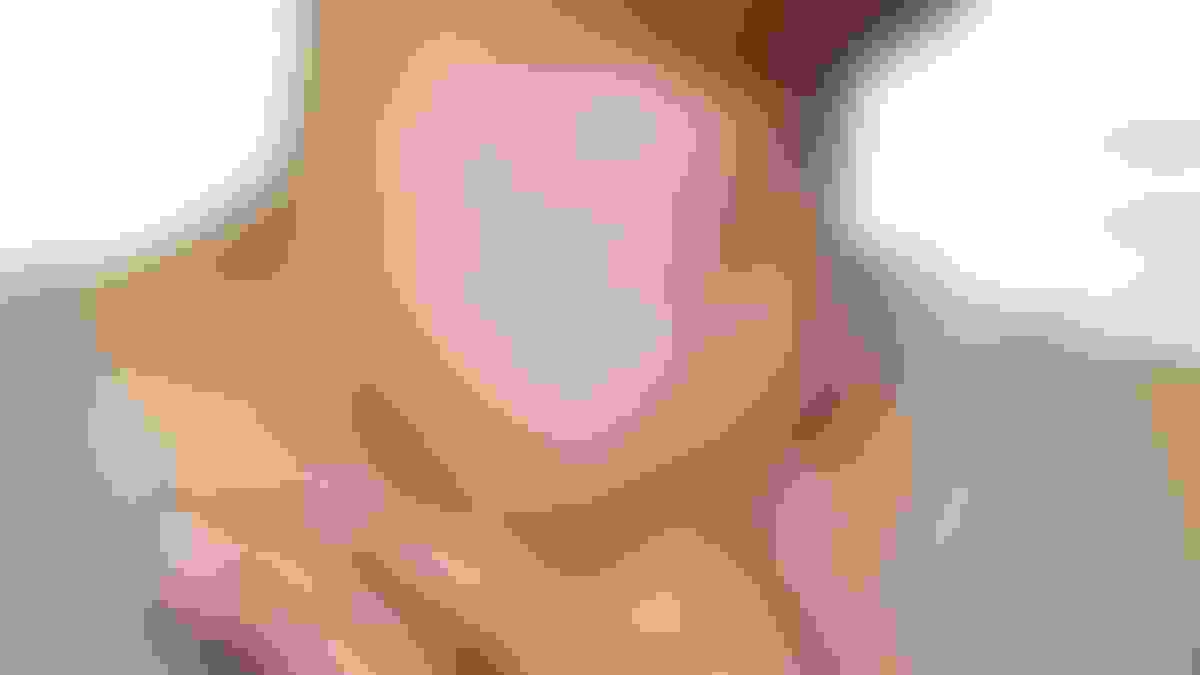 Goiter on neck