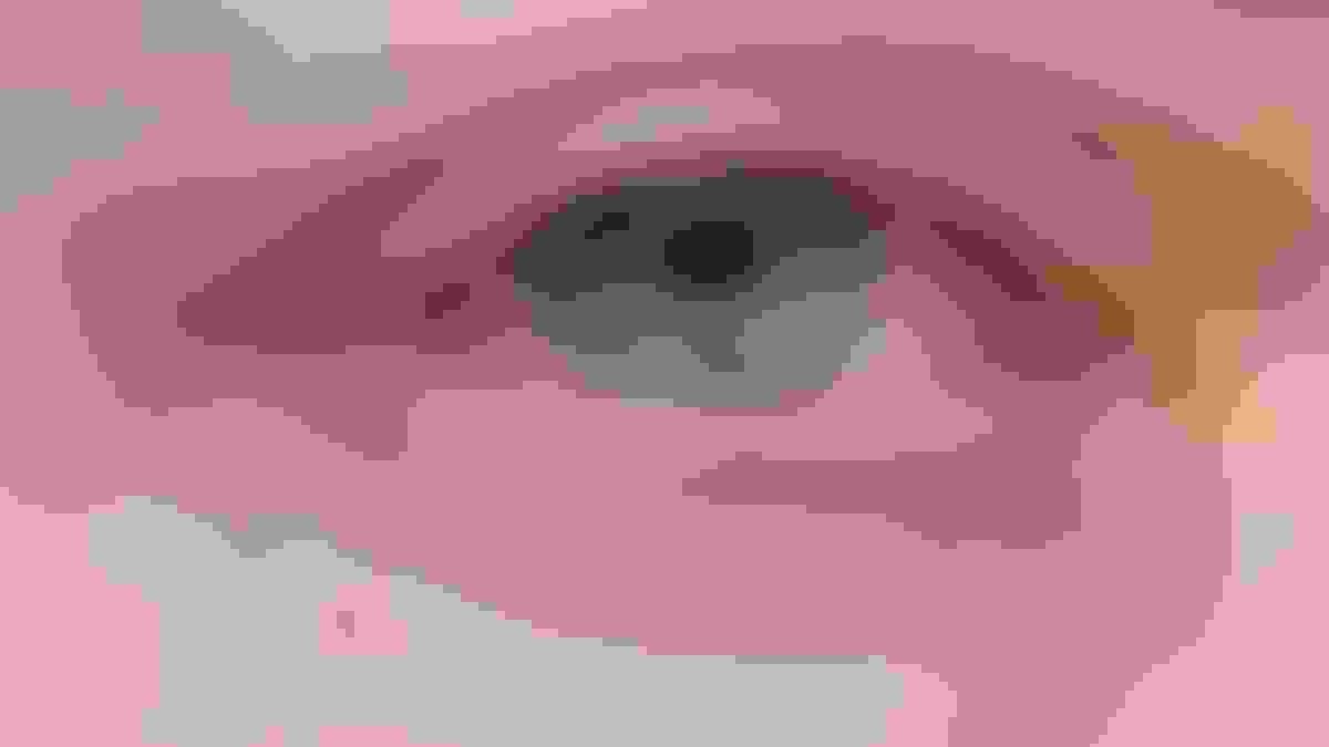 closeup of an eye with conjunctivitis