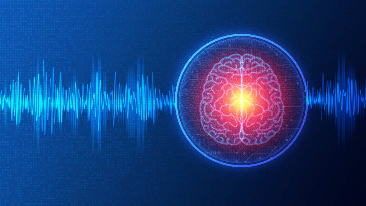 illustration of Electroconvulsive therapy (ECT)