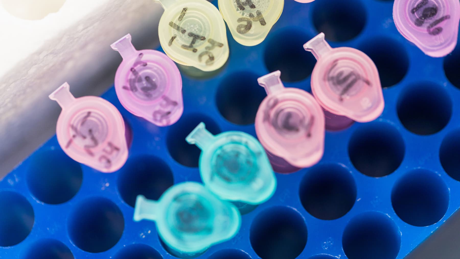 试管中装有 DNA 样本，这些样本将被送去进行分子诊断检测。