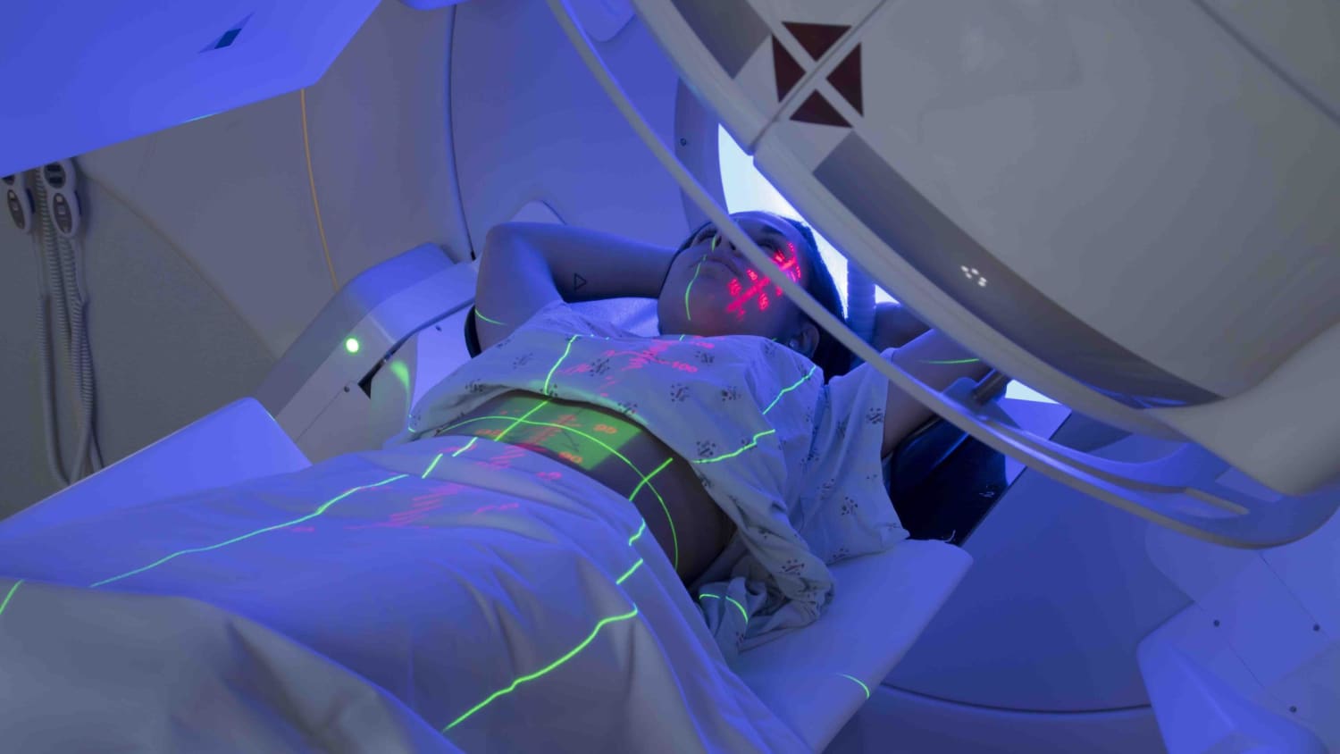 Rapid Radiation Therapy That Takes a Fraction of the Time > News > Yale  Medicine