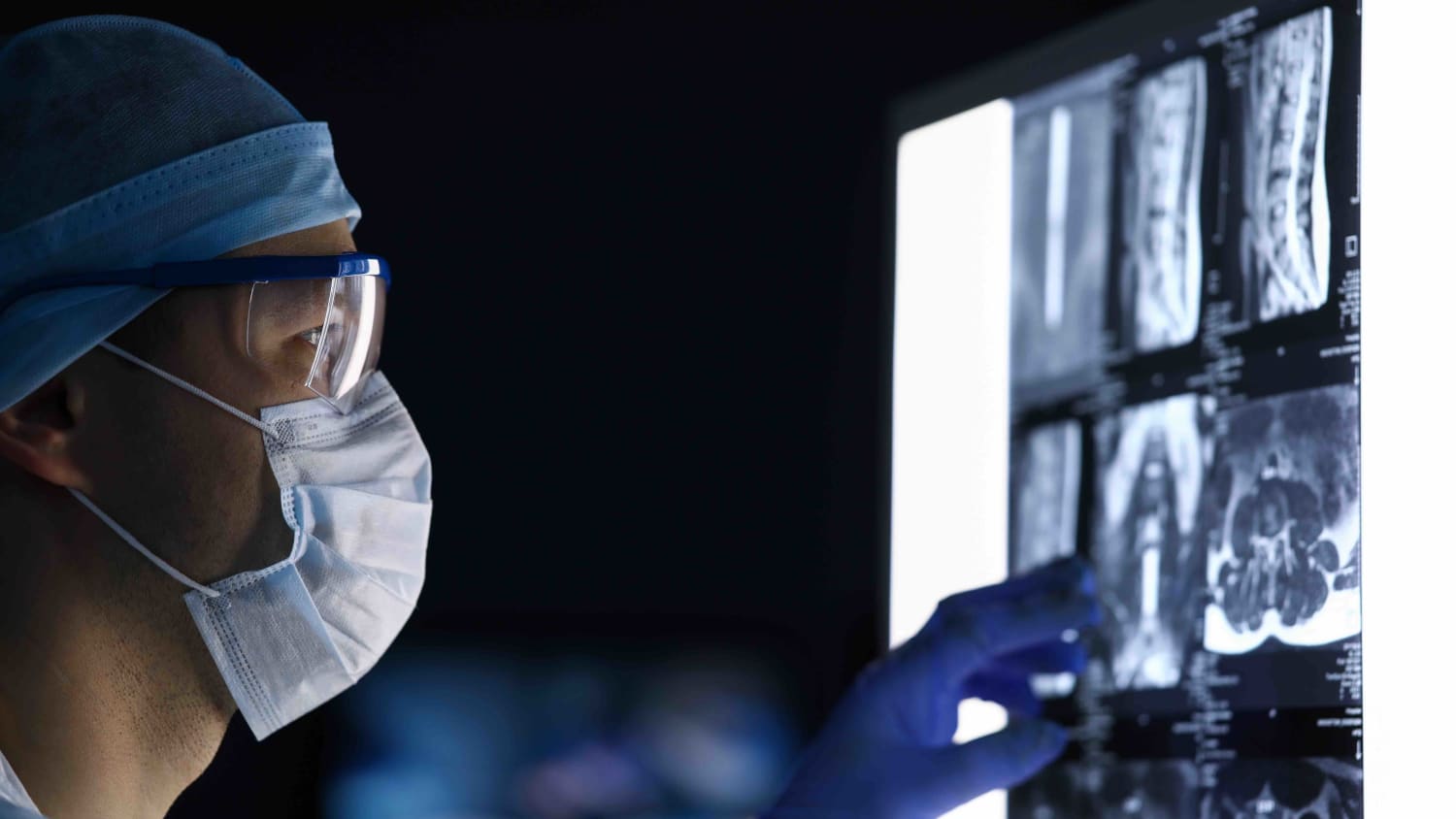 Radiology & Biomedical Imaging | Departments | Yale Medicine