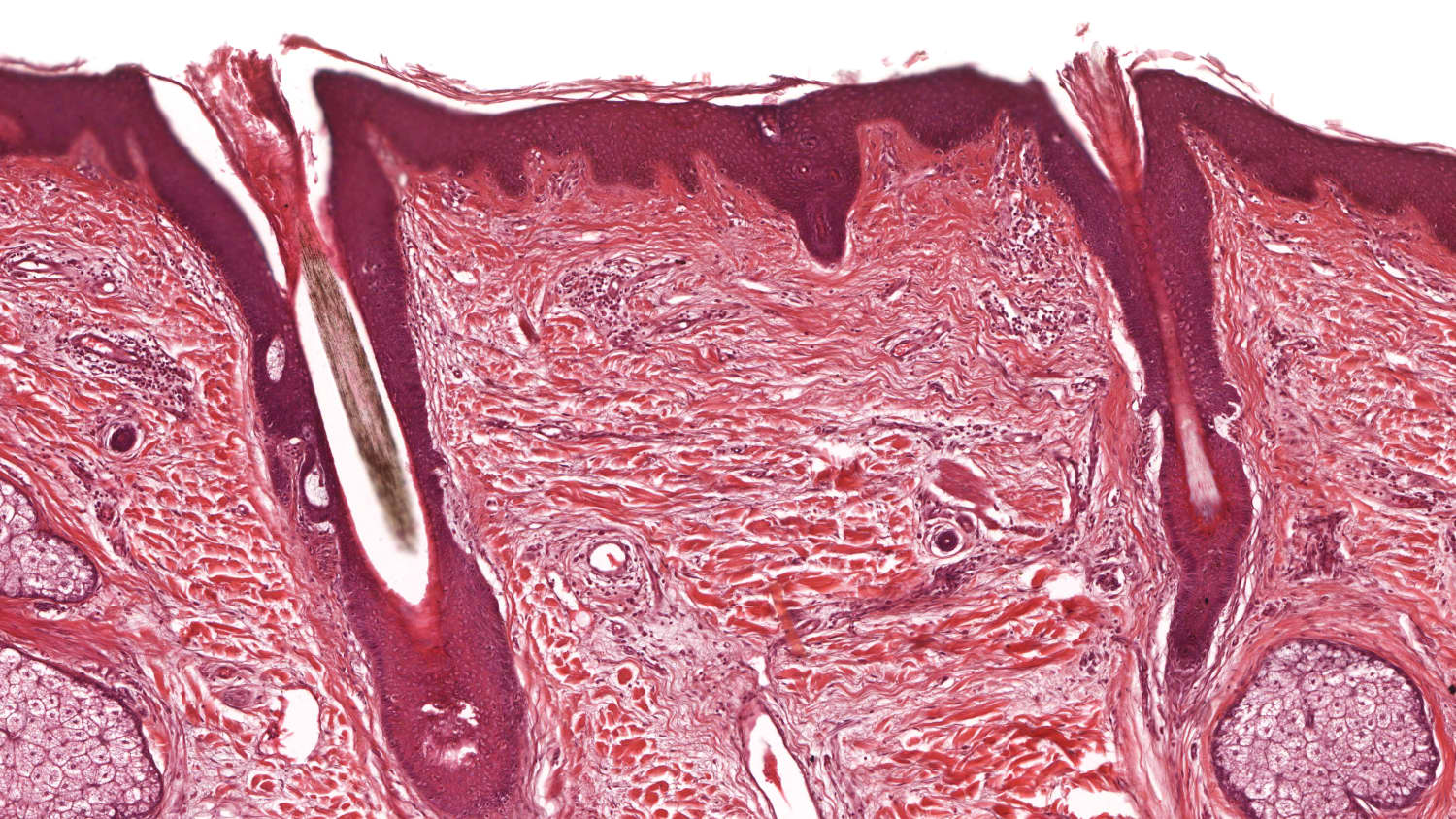 Skin Biopsies: What You Should Expect > News > Yale Medicine