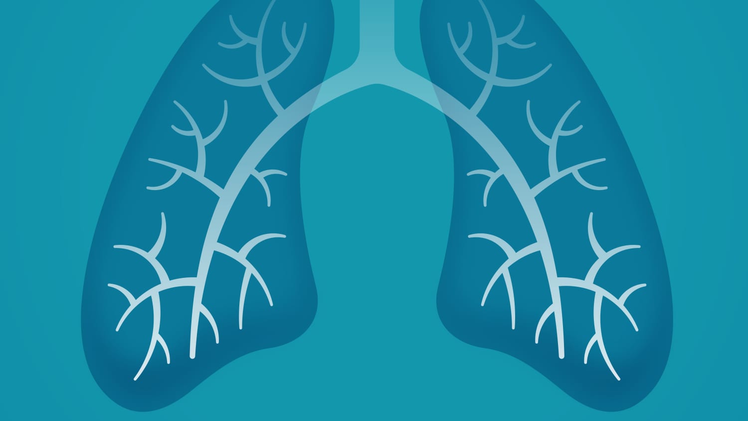 3 Things to Know About Lung Cancer Screening > News > Yale Medicine