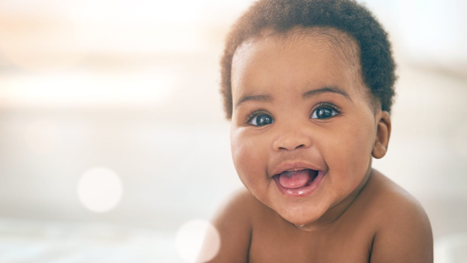 close-up of a baby that has had craniofacial surgery