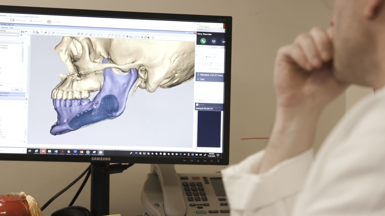 A surgeon examines a 3D model of a skull during a surgery planning session.