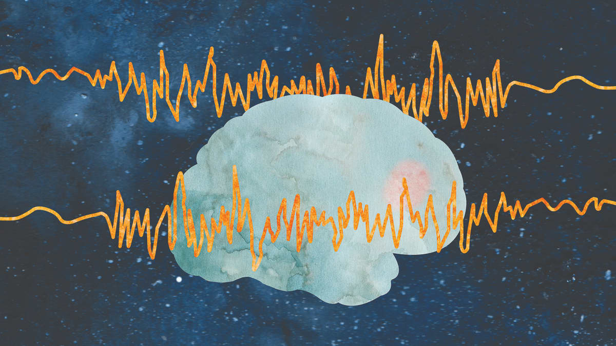 Illustration of a brain EEG, showing epilepsy