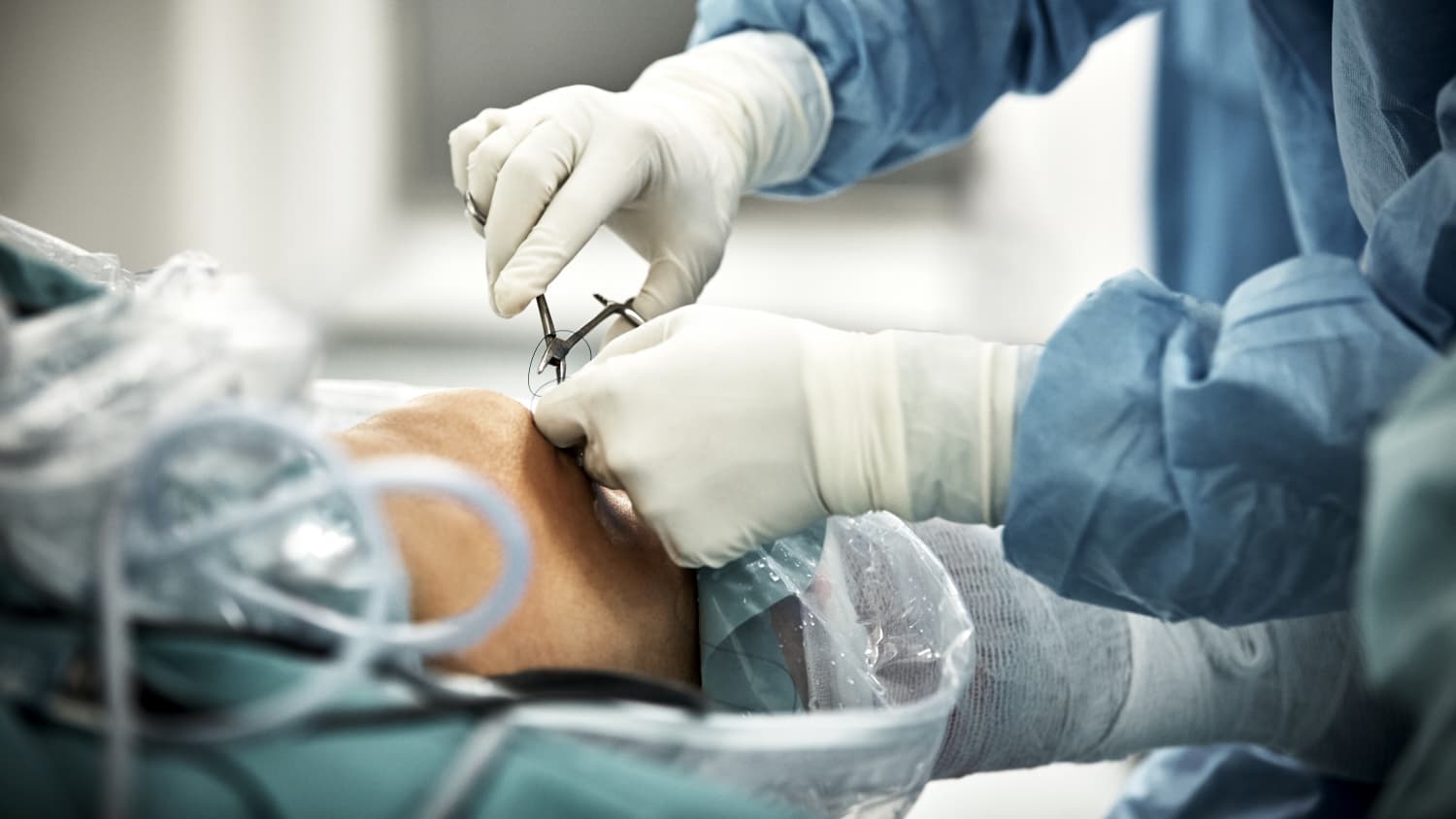 surgeon performing arthroscopy