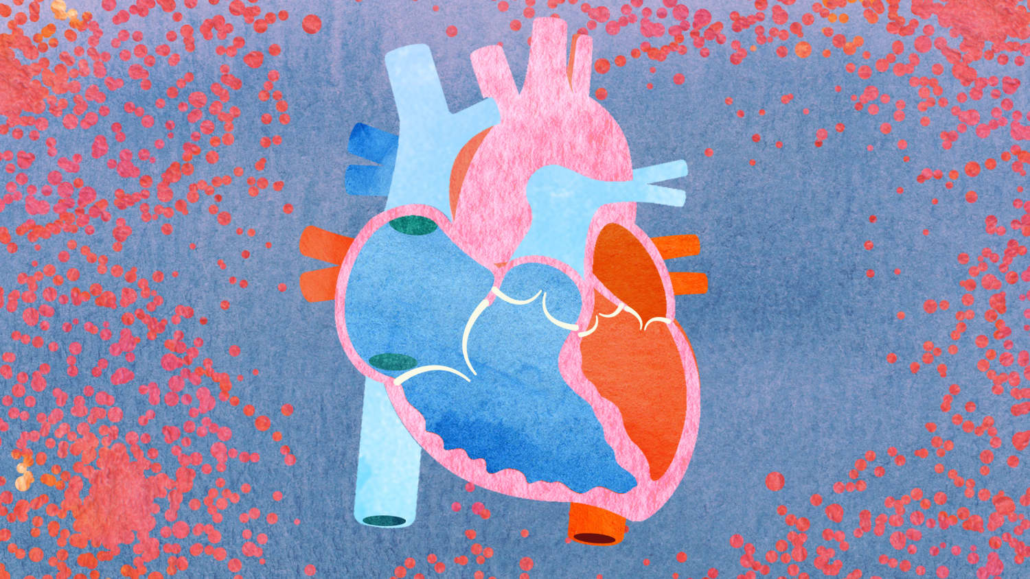 Heart illustration focusing on cardio-oncology