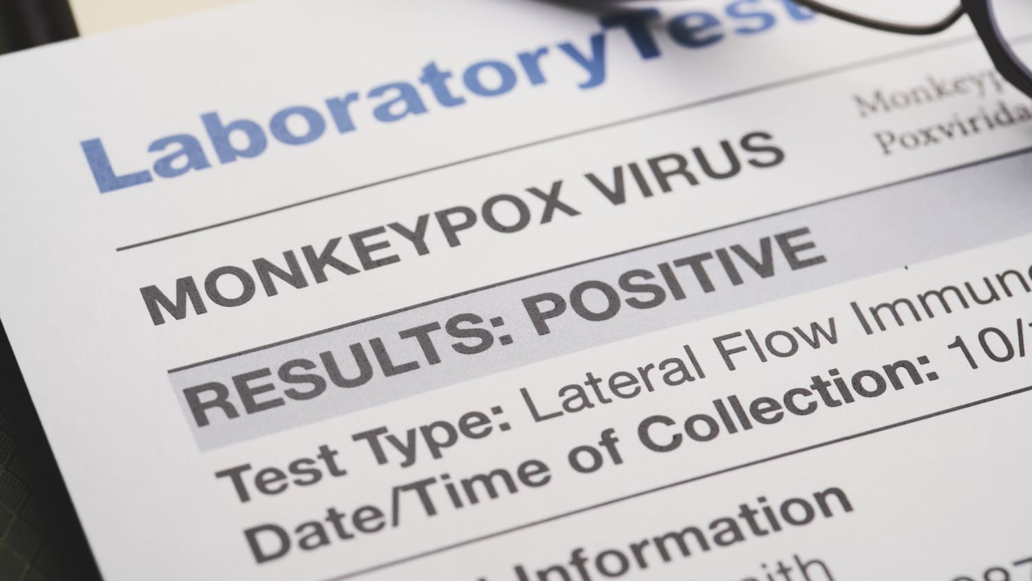 Monkeypox virus test results document