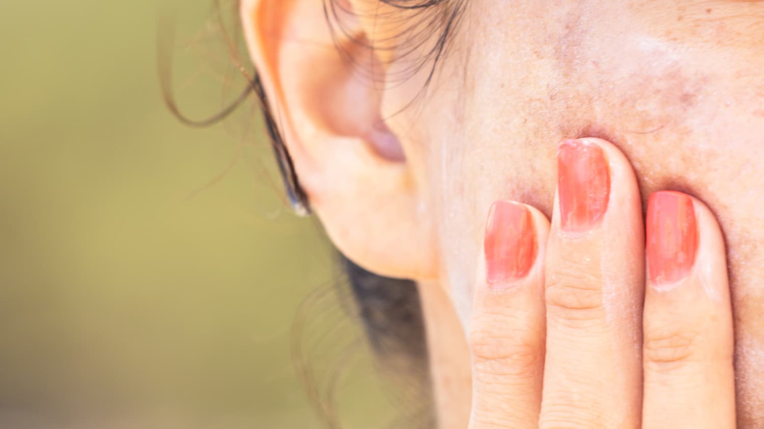 woman touching skin on her face, who possibly has skin cancer