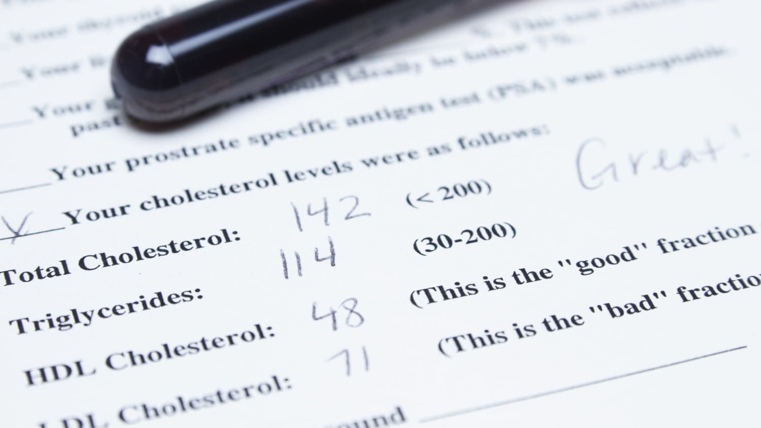 Cholesterol test result