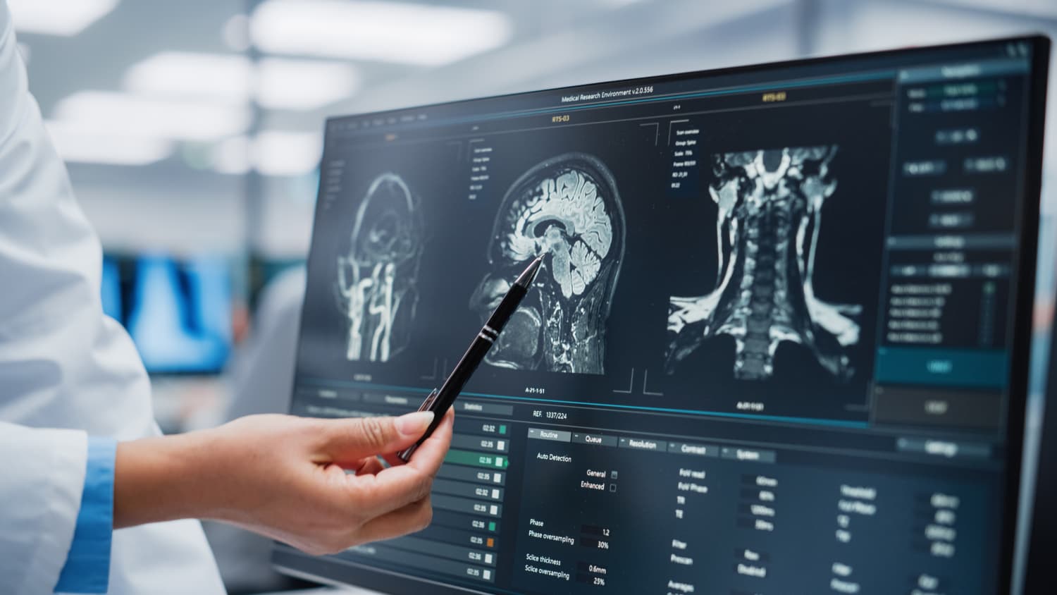 doctor reading brain scans off a screen