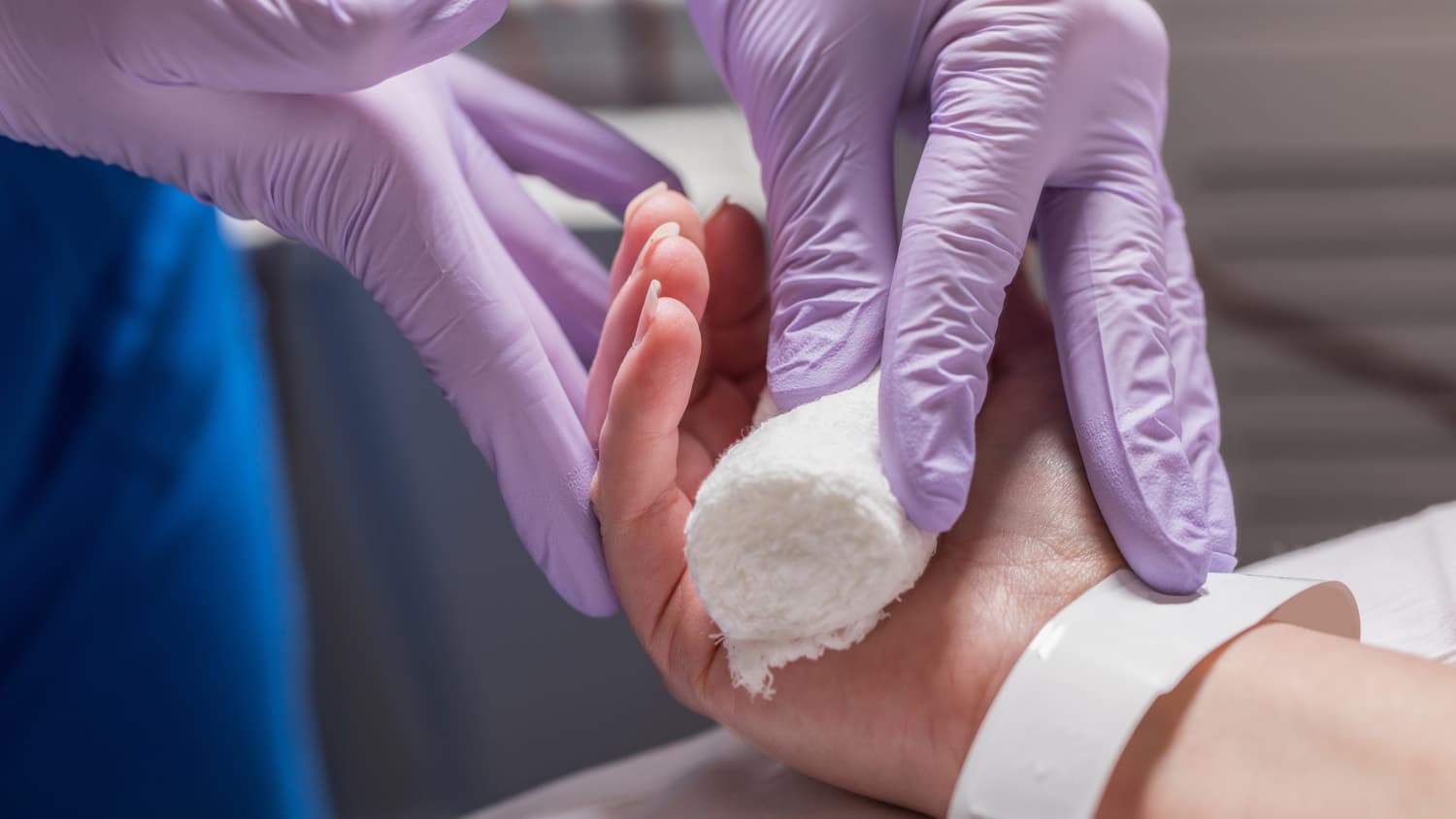 a provider wearing purple gloves prepares a patient's hand for dialysis