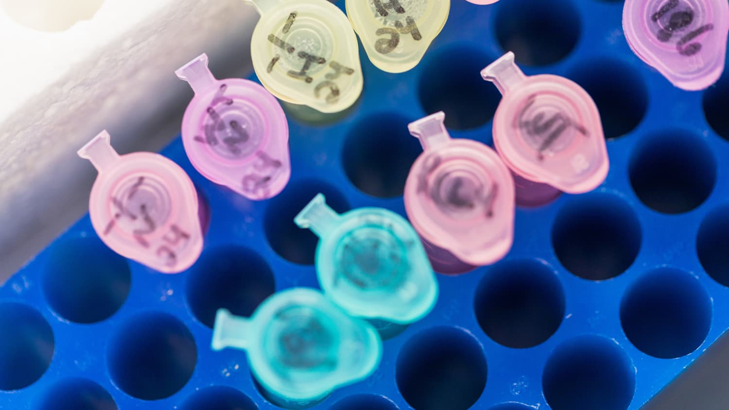 Test tubes hold samples of DNA that will be sent for molecular diagnostic testing. 