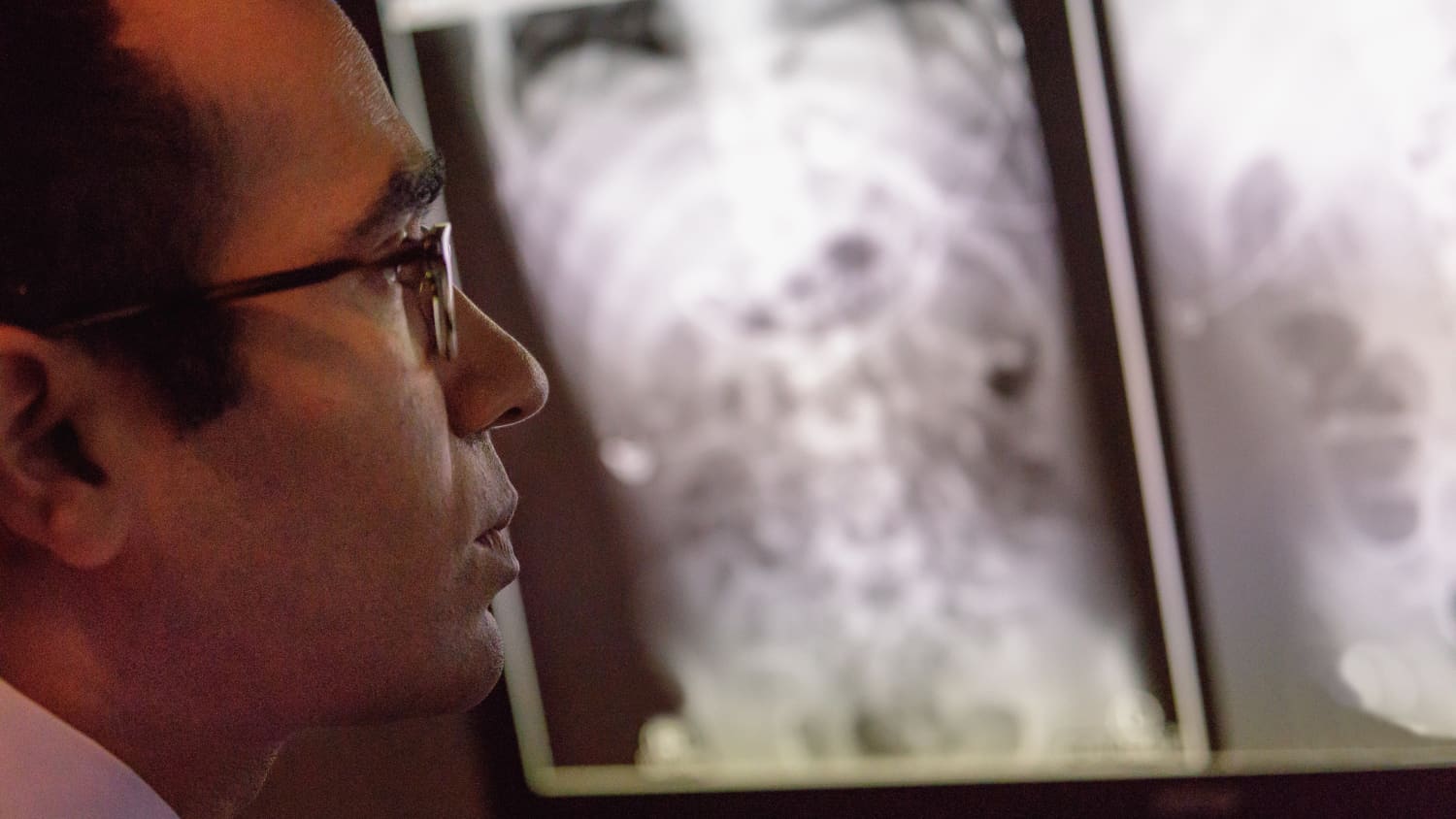 Jay Pahade, MD, looking at an xray