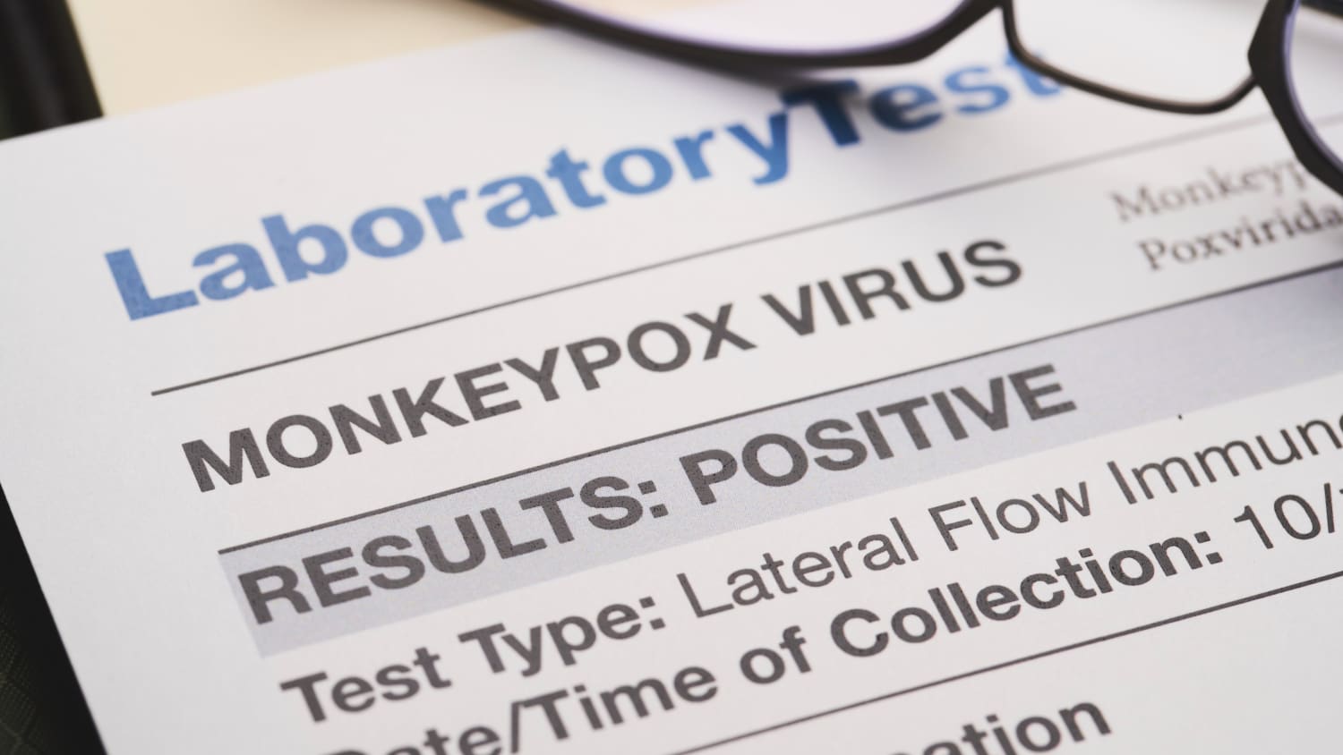 Monkeypox virus test results document