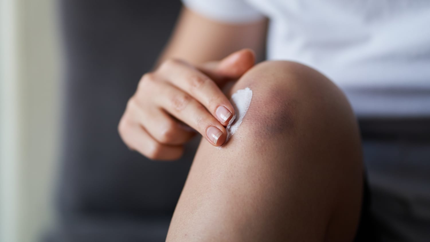 person who bruises easily from bleeding disorders putting on cream
