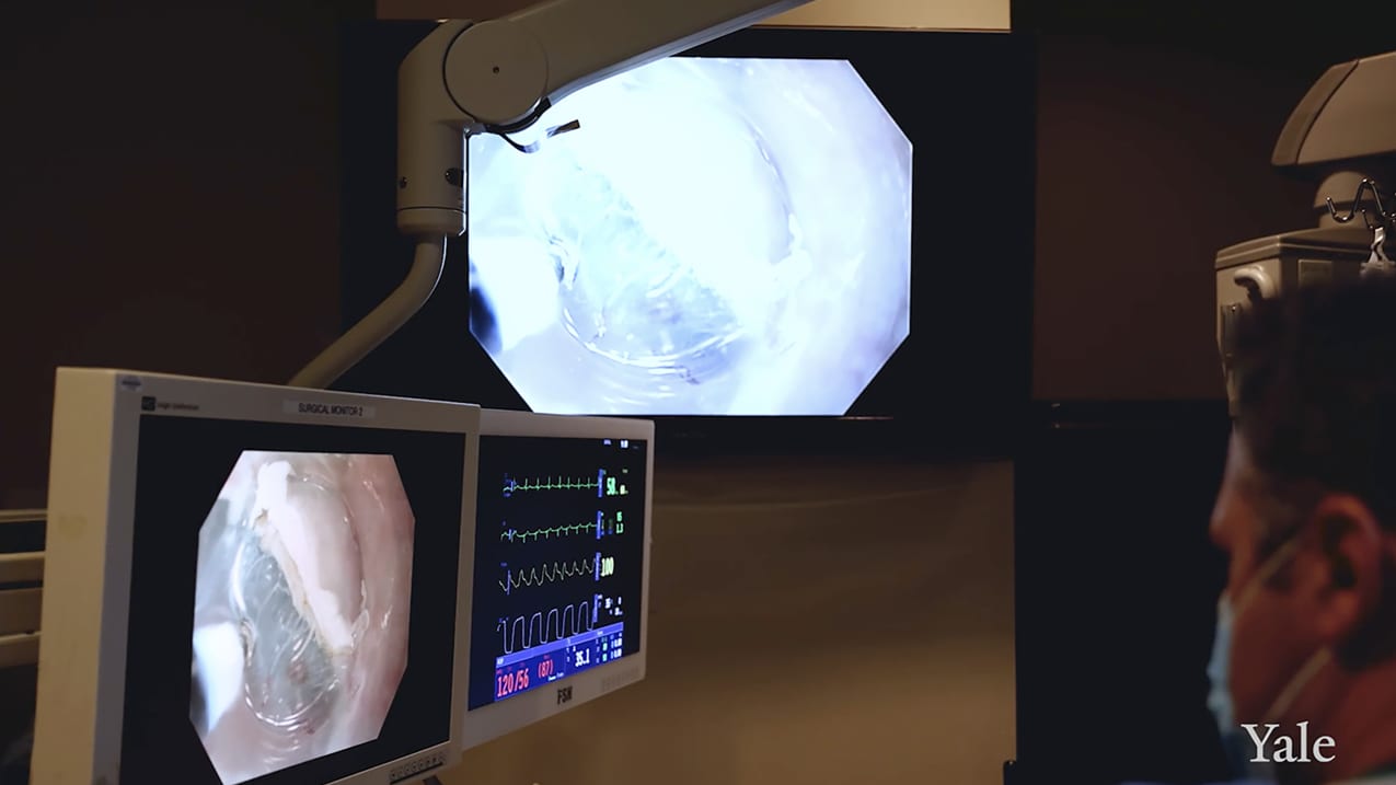 A doctor looks at a screen with endoscopic imaging.