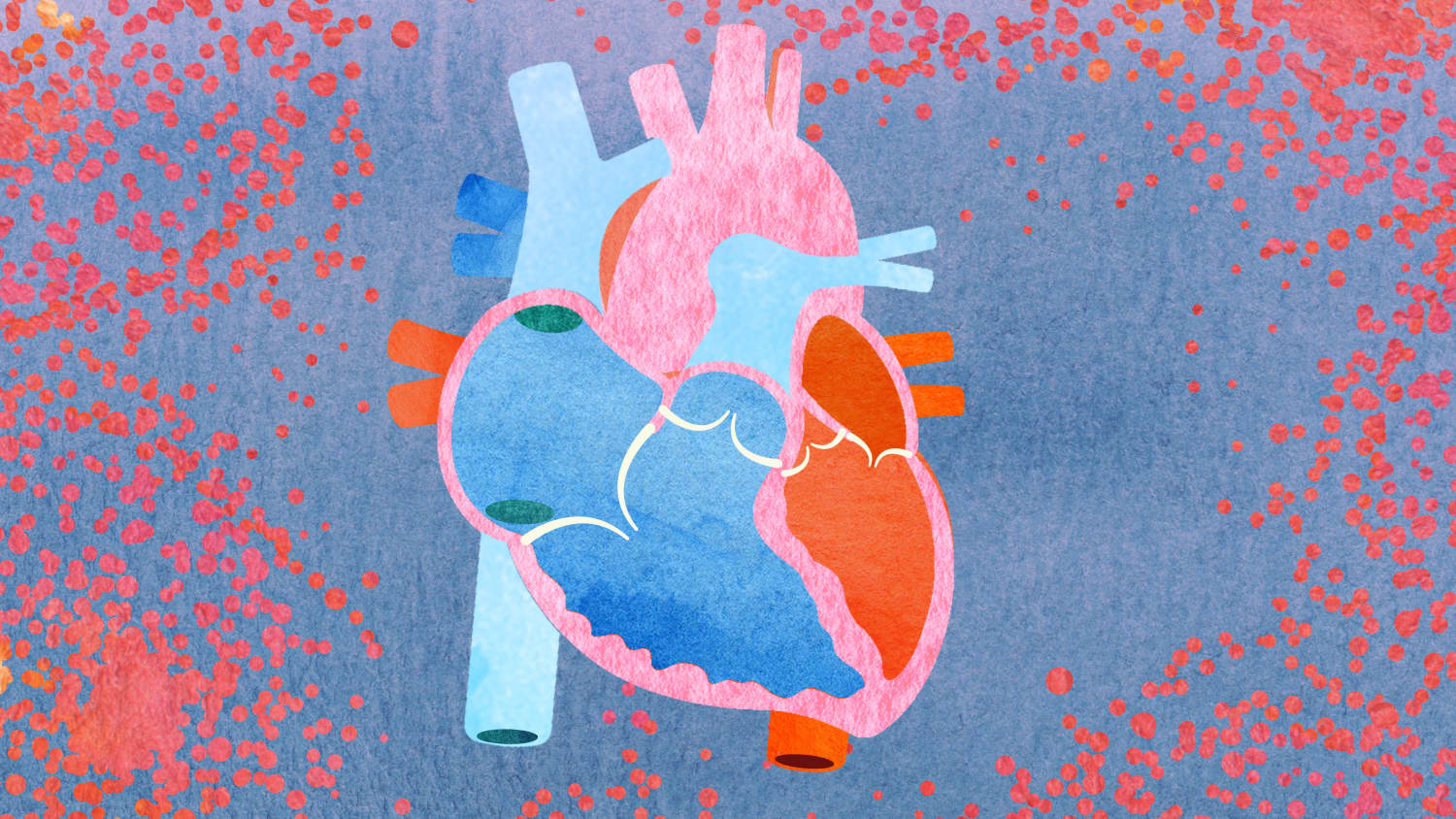 Heart illustration focusing on cardio-oncology