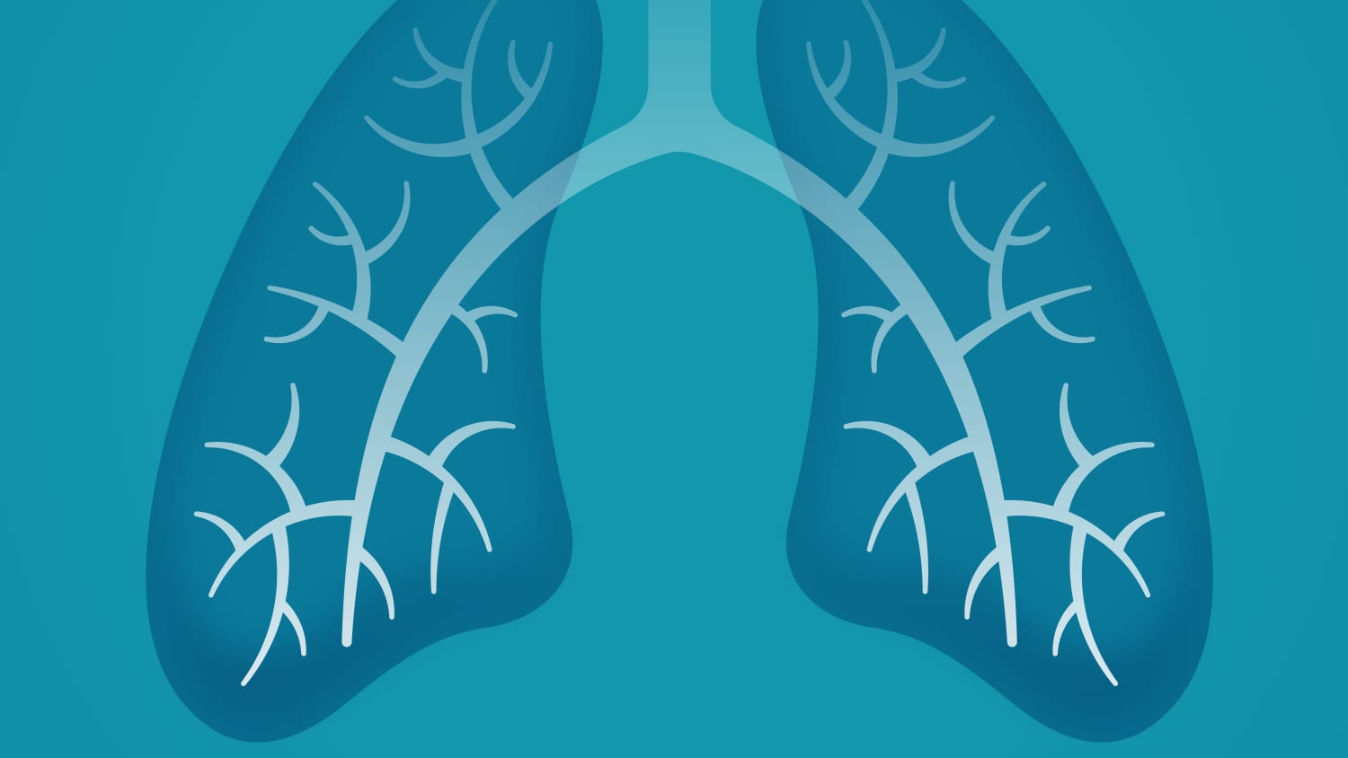 illustration of lungs, highlighting the need for lung cancer screening