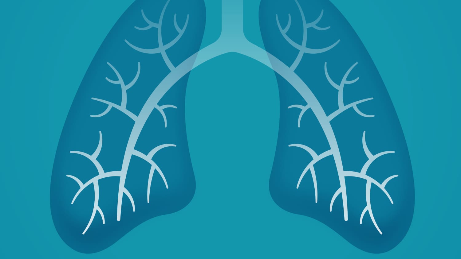illustration of lungs, highlighting the need for lung cancer screening