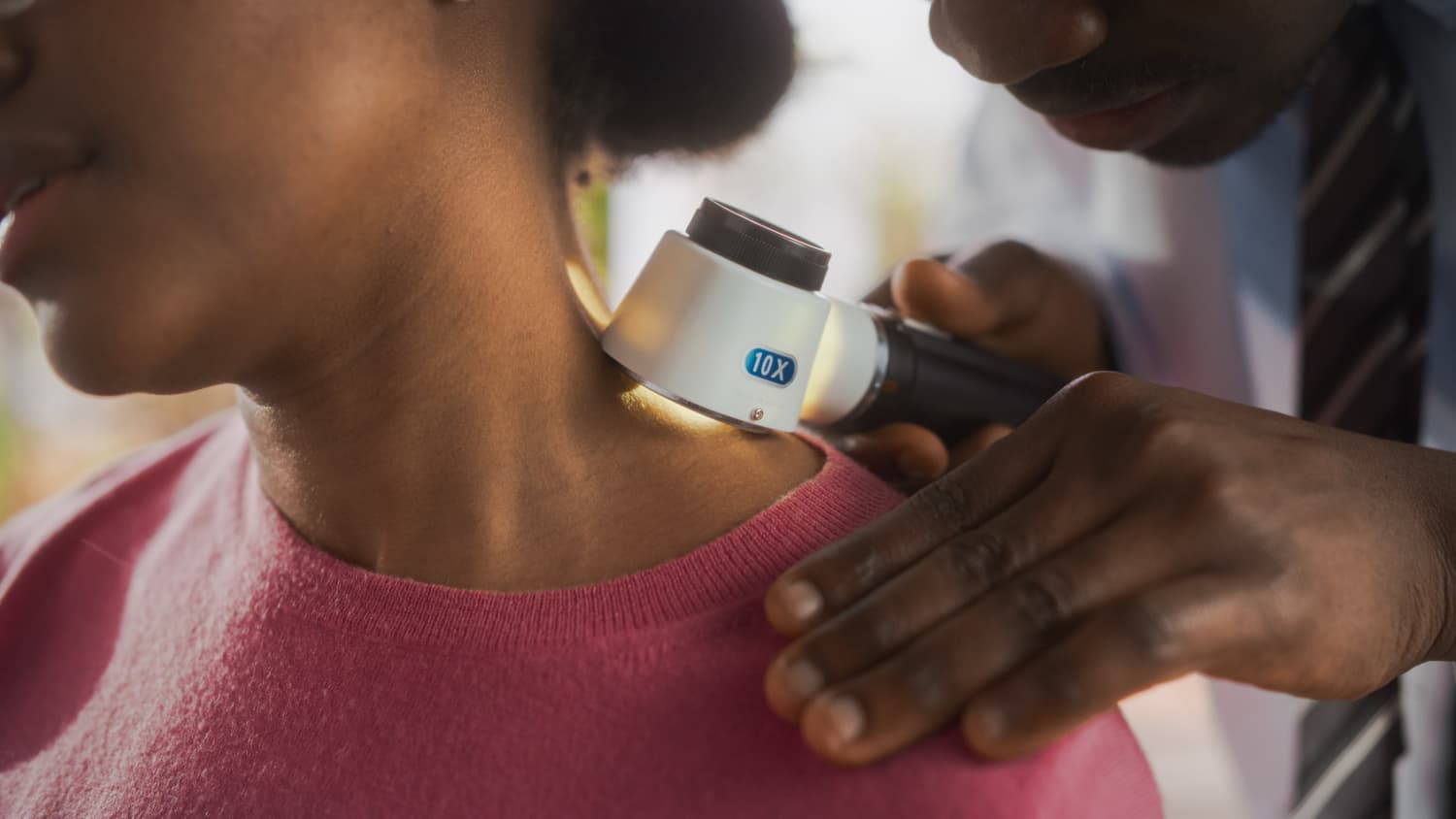 Doctor Examines Patient's Skin with Dermatoscope