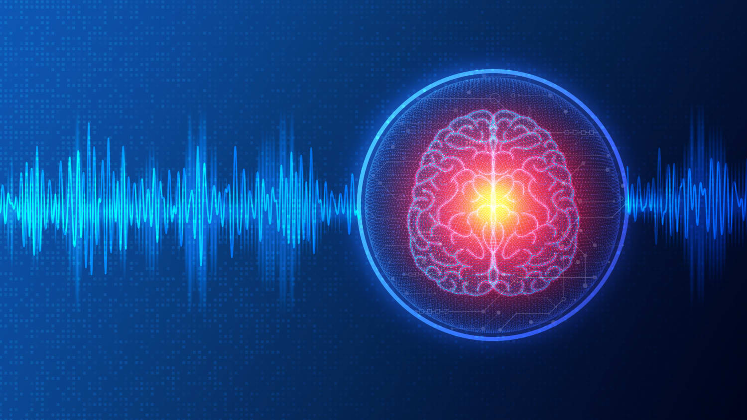 illustration of Electroconvulsive therapy (ECT)