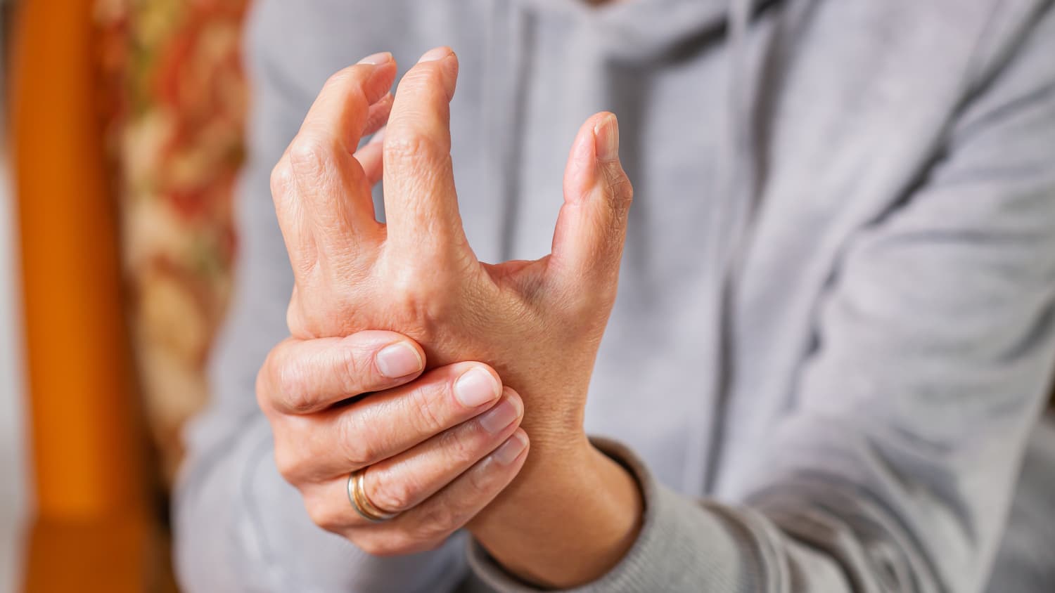 A woman with rheumatoid arthritis massages her swollen hand.