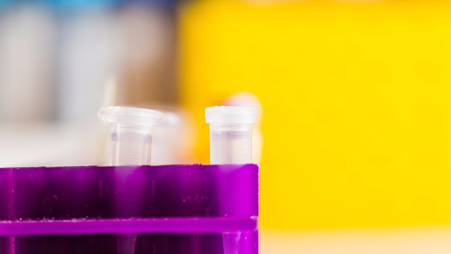 Scientific detail in a lab, test tubes with a yellow background.