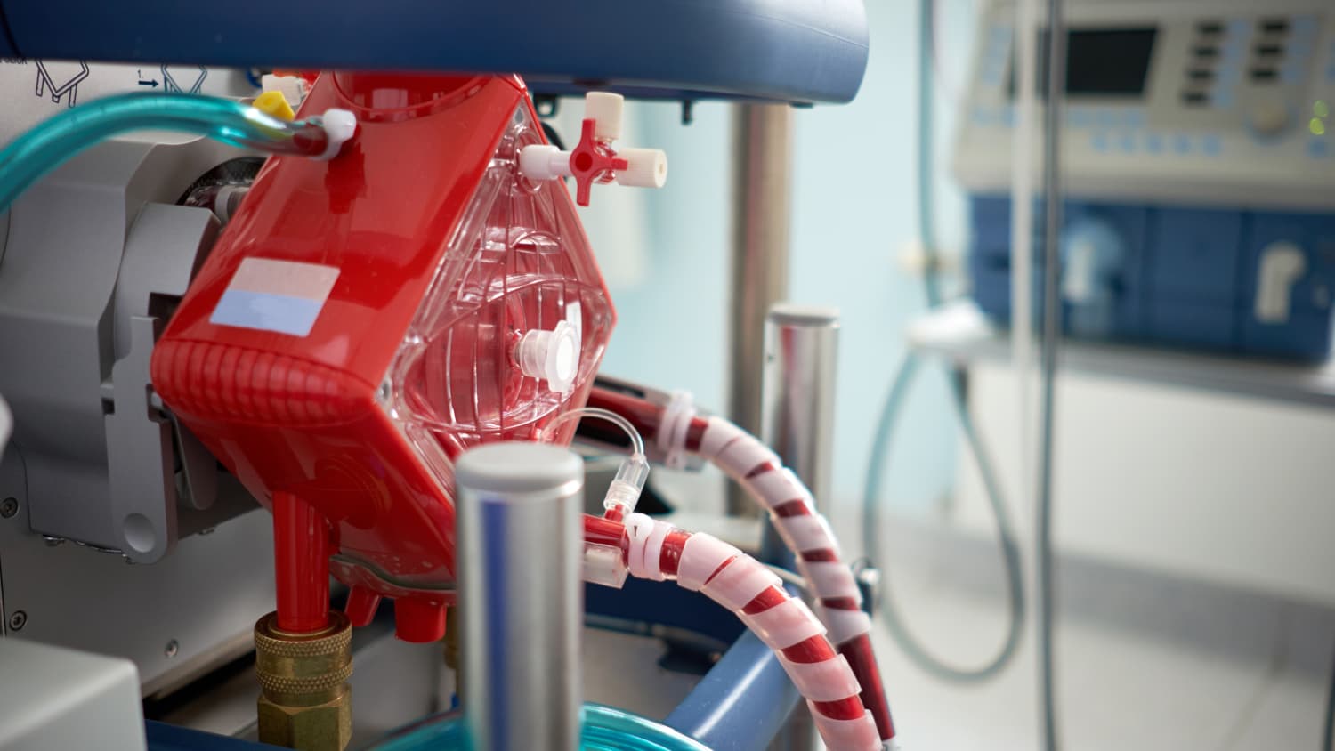 Extracorporeal Membrane Oxygenation (ECMO) machine