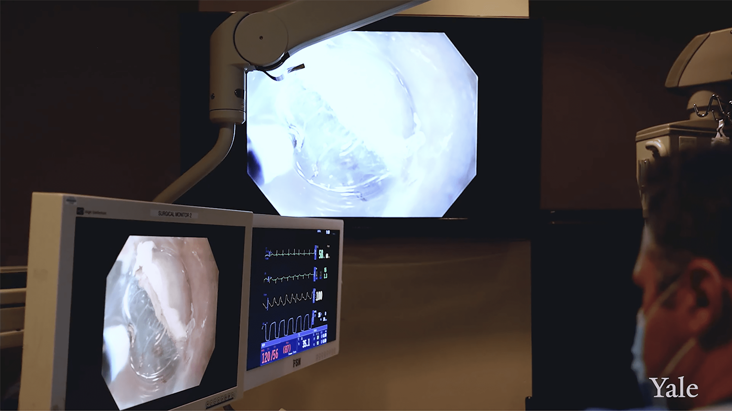 A doctor looks at a screen with endoscopic imaging.