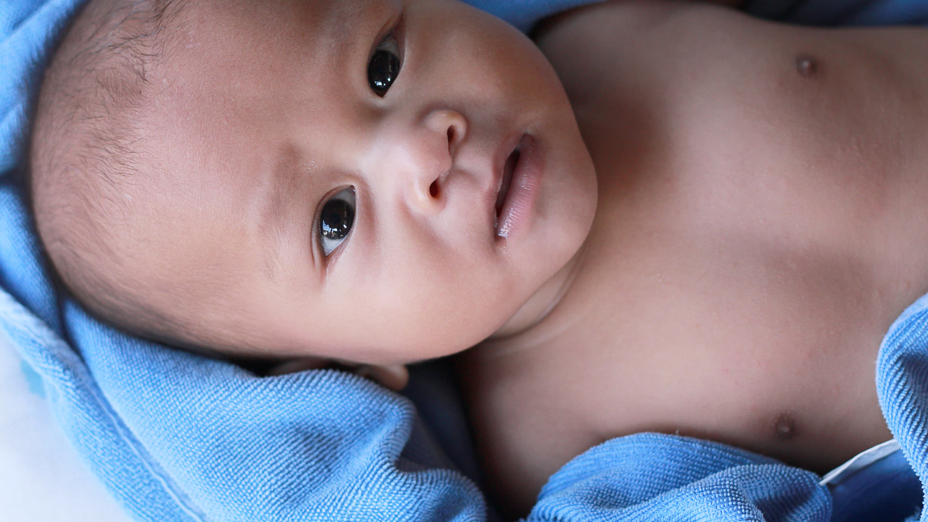 A baby with a fever rests on a blue blanket.