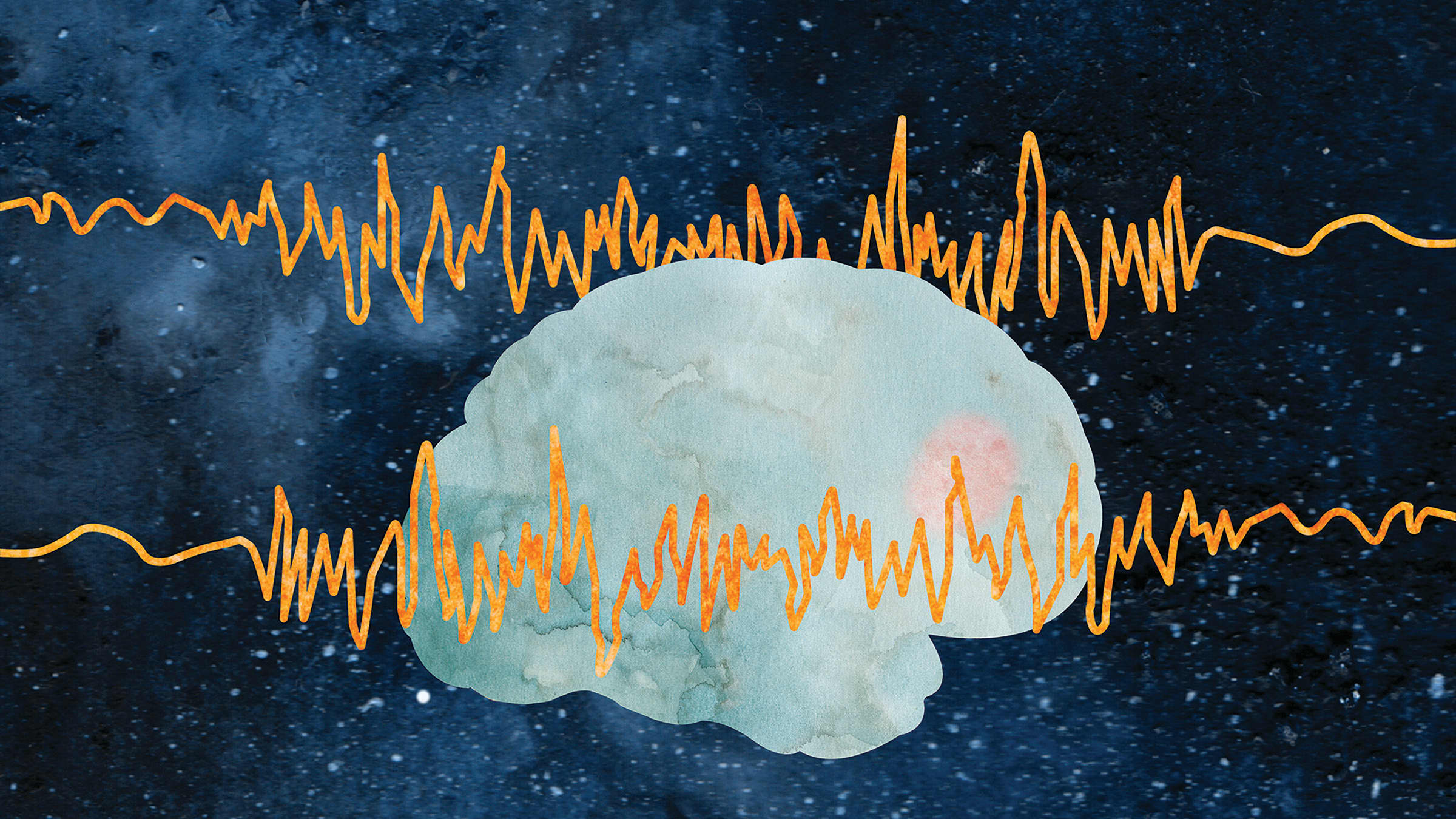 Illustration of a brain EEG, showing epilepsy