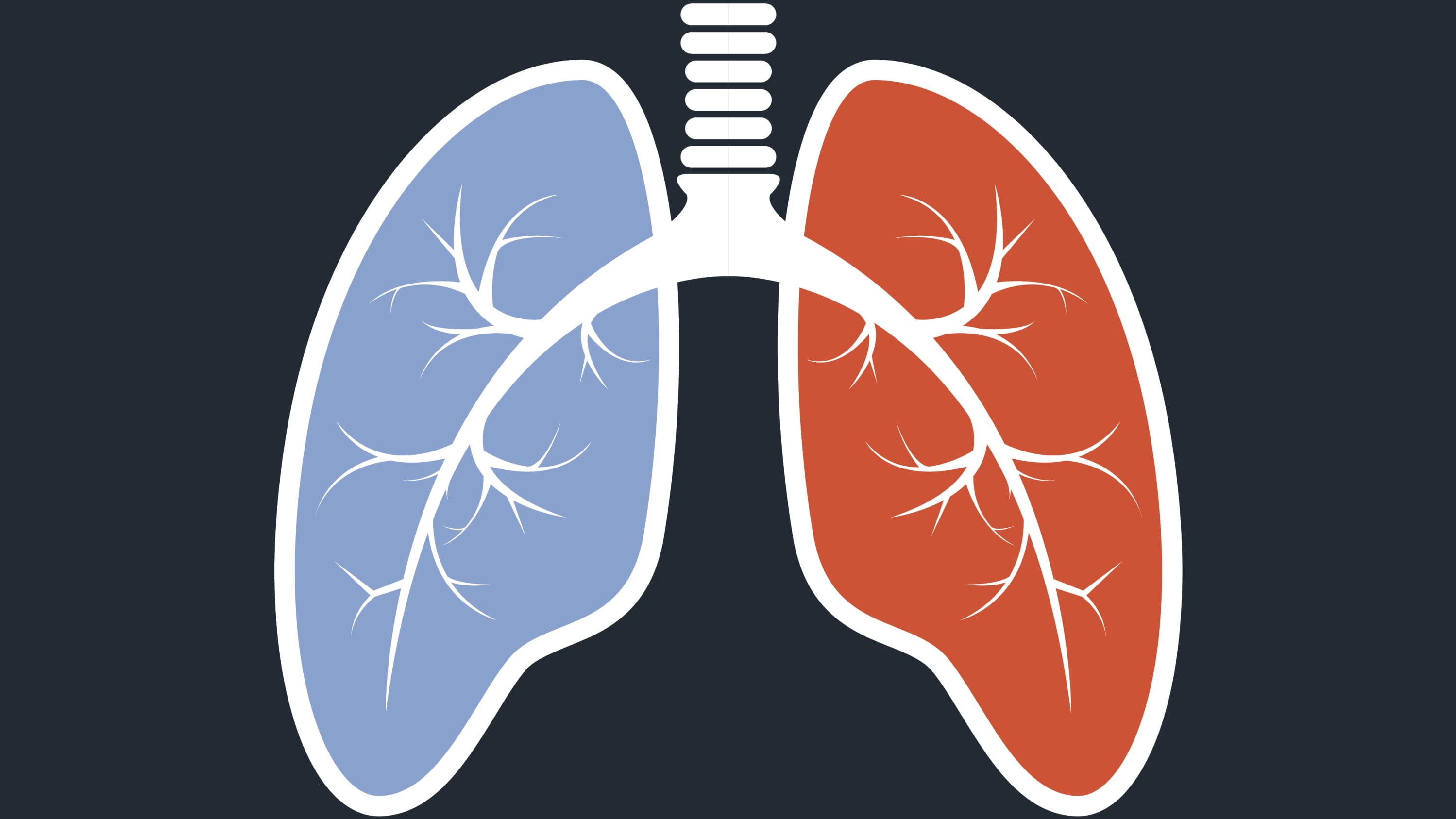 illustration of lungs, as a way of describing pulmonary arterial hypertension