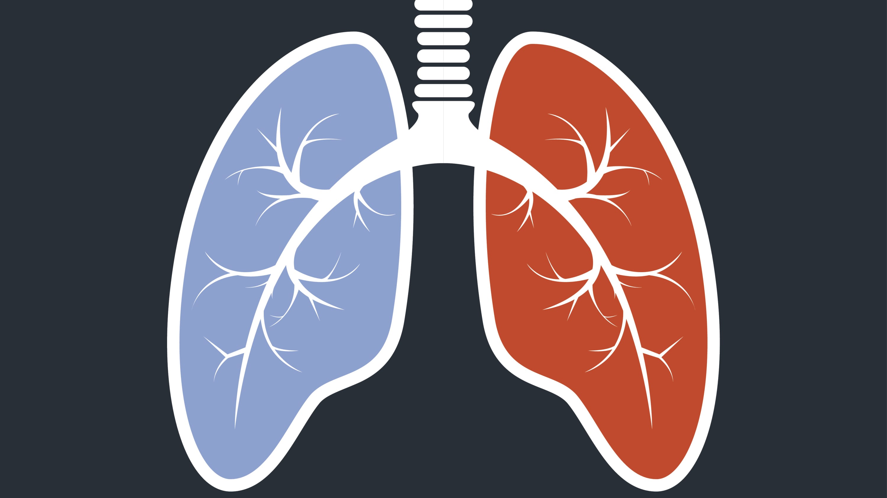 illustration of lungs, as a way of describing pulmonary arterial hypertension