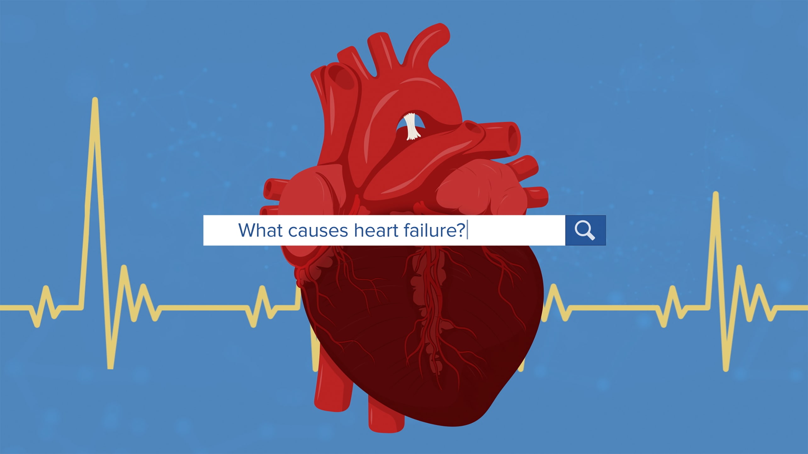 A drawing of a heart with the text "What causes heart failure?" over it.