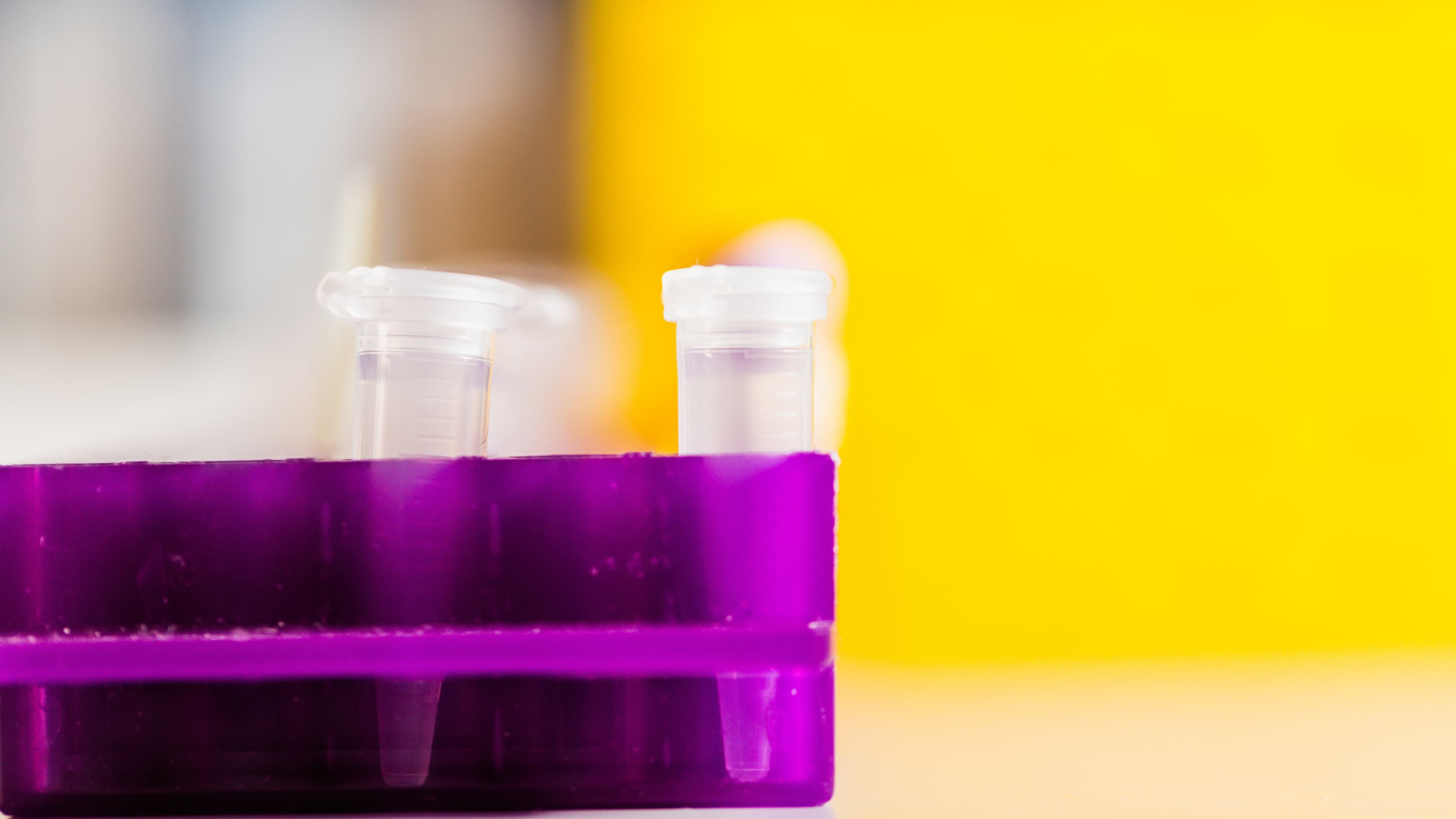 Scientific detail in a lab, test tubes with a yellow background.
