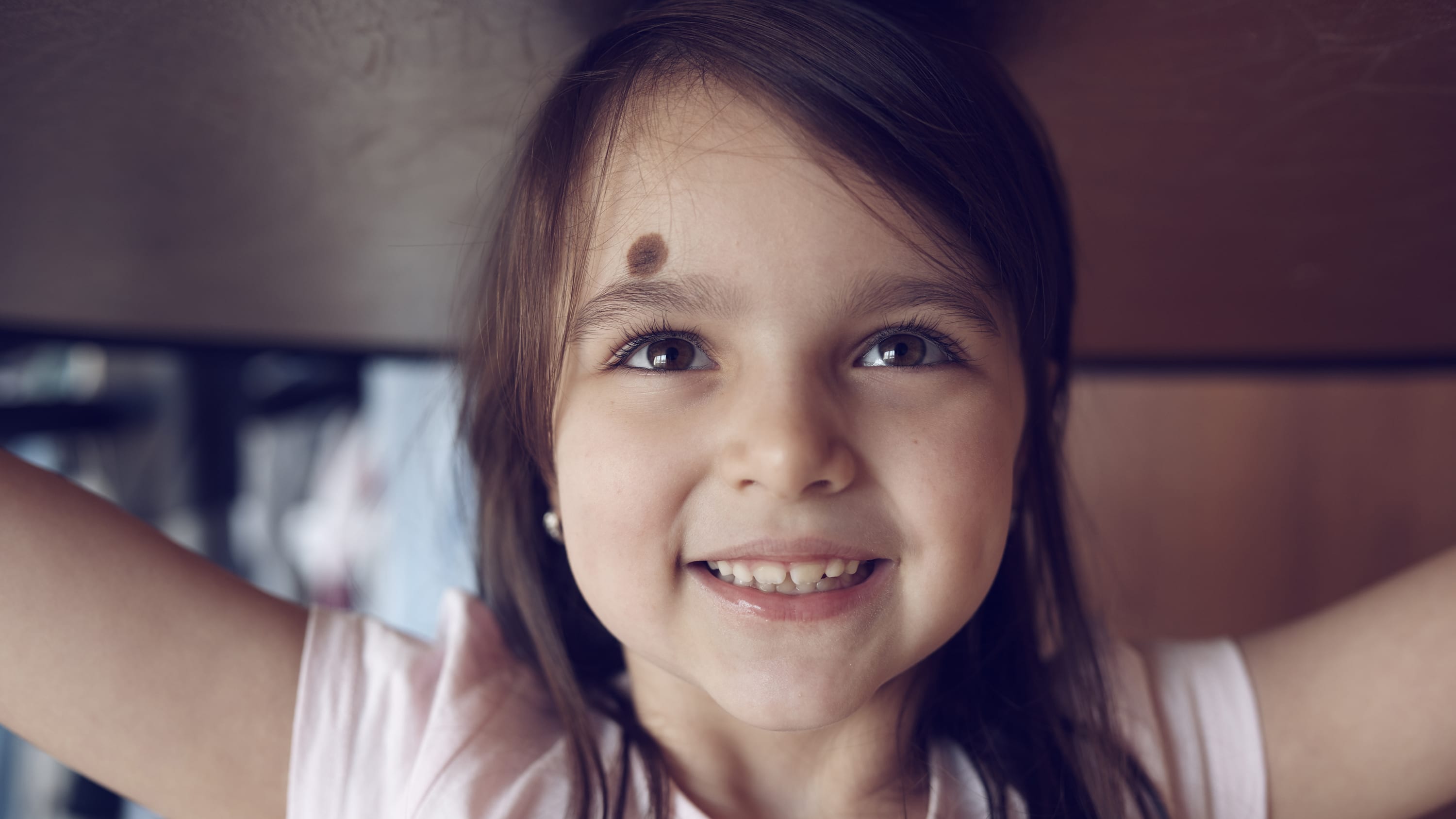 a young girl with a large birthmark on her forehead smiles