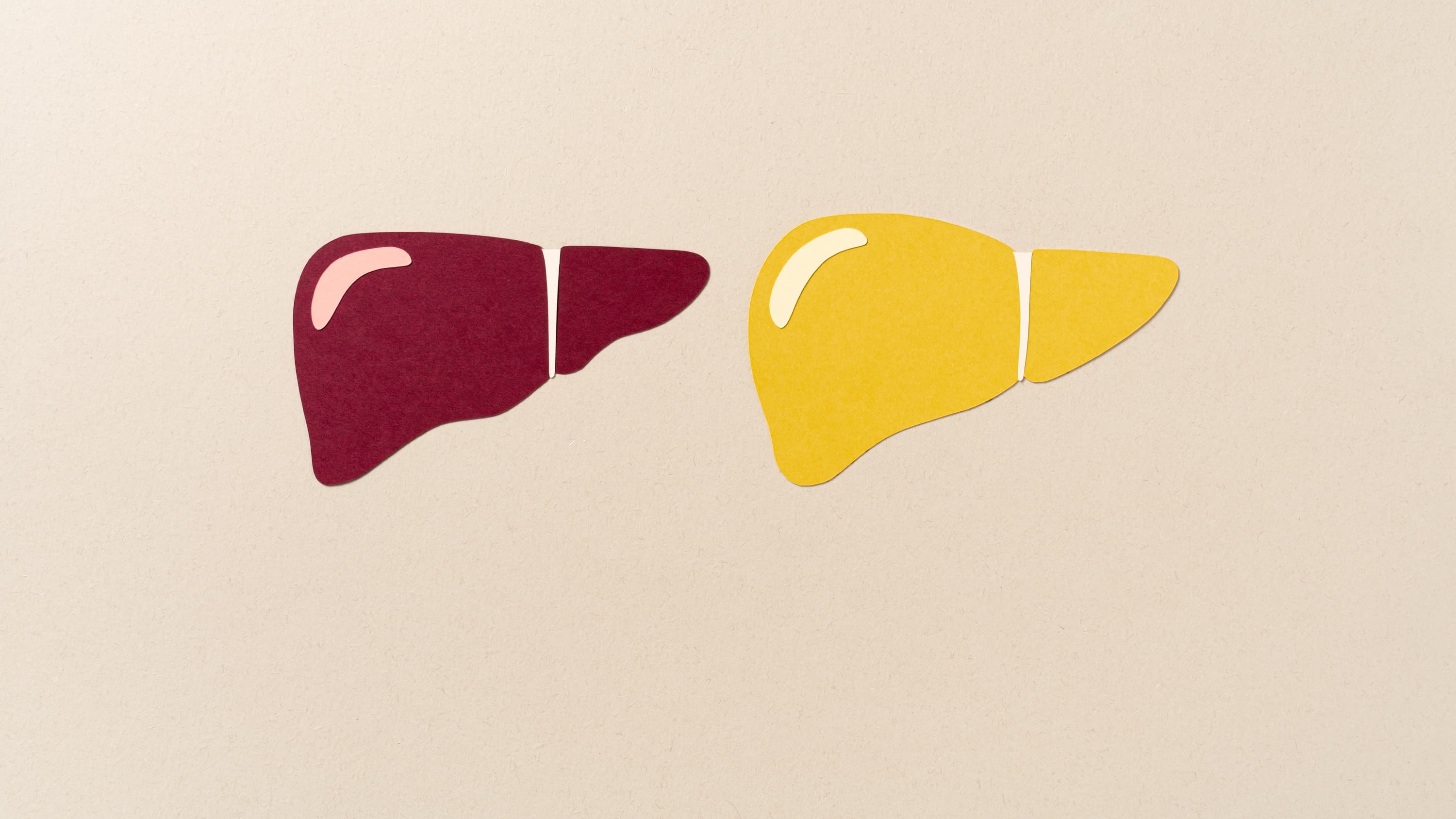 Fda approves rezdiffra the first drug for nash a form of fatty liver