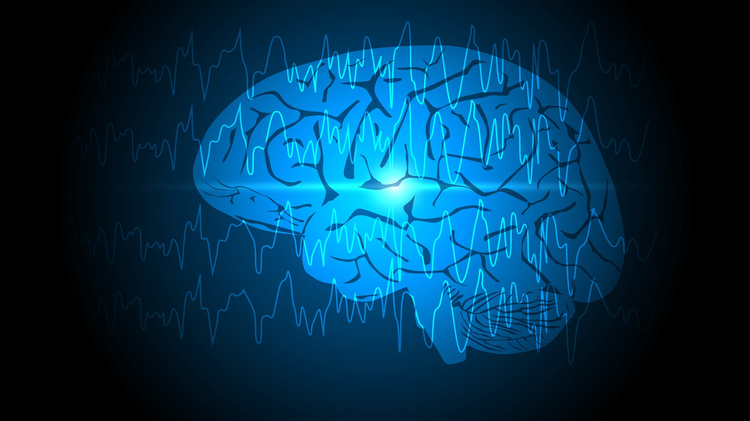 Abnormal brain waves or EEG arising from one region of brain, representing epilepsy or seizures
