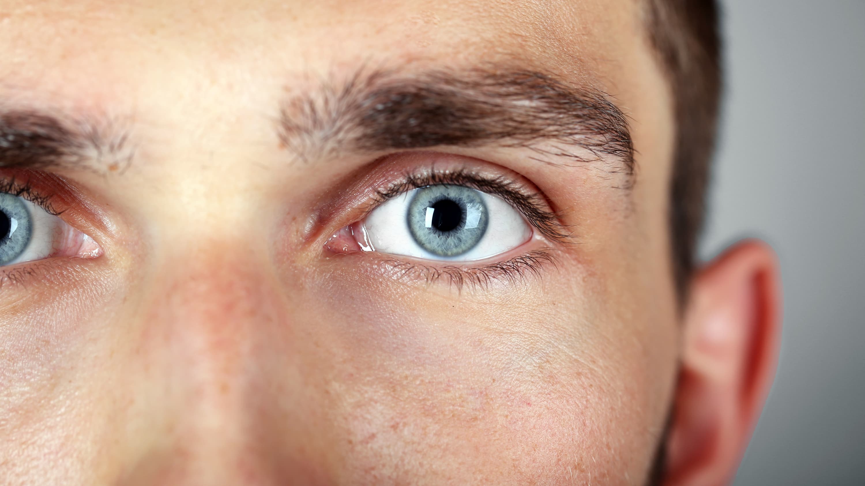 Close up of a man with blue eyes who possibly has a benign eyelid or eye growth