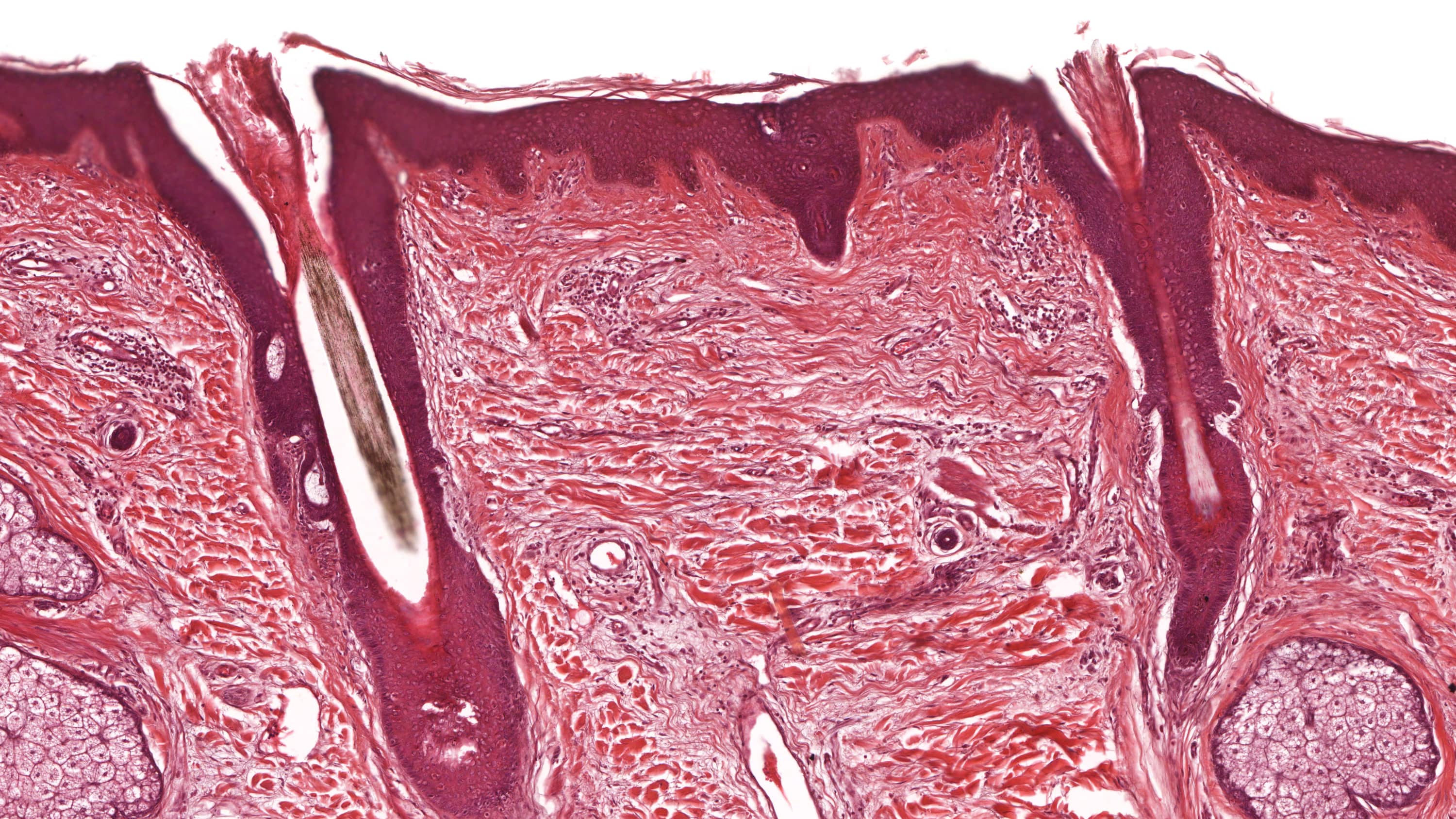 Skin Biopsies What You Should Expect > News > Yale Medicine