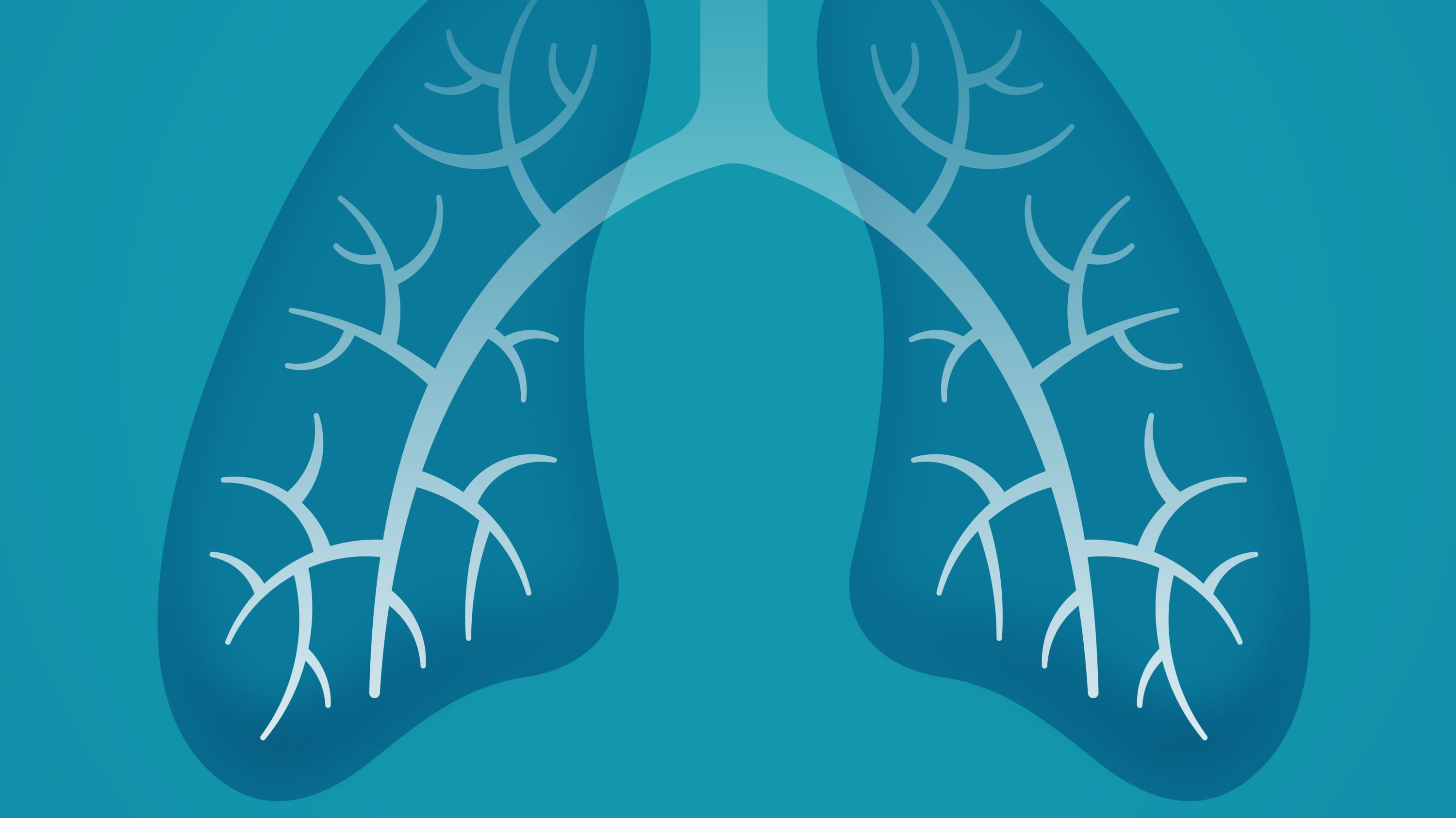 illustration of lungs, highlighting the need for lung cancer screening