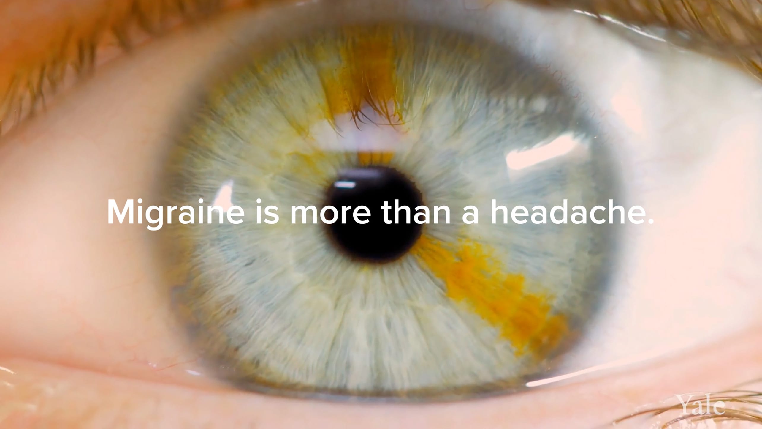 Extreme closeup image of a hazel-colored human eye with text that reads "Migraine is more than a headache" 