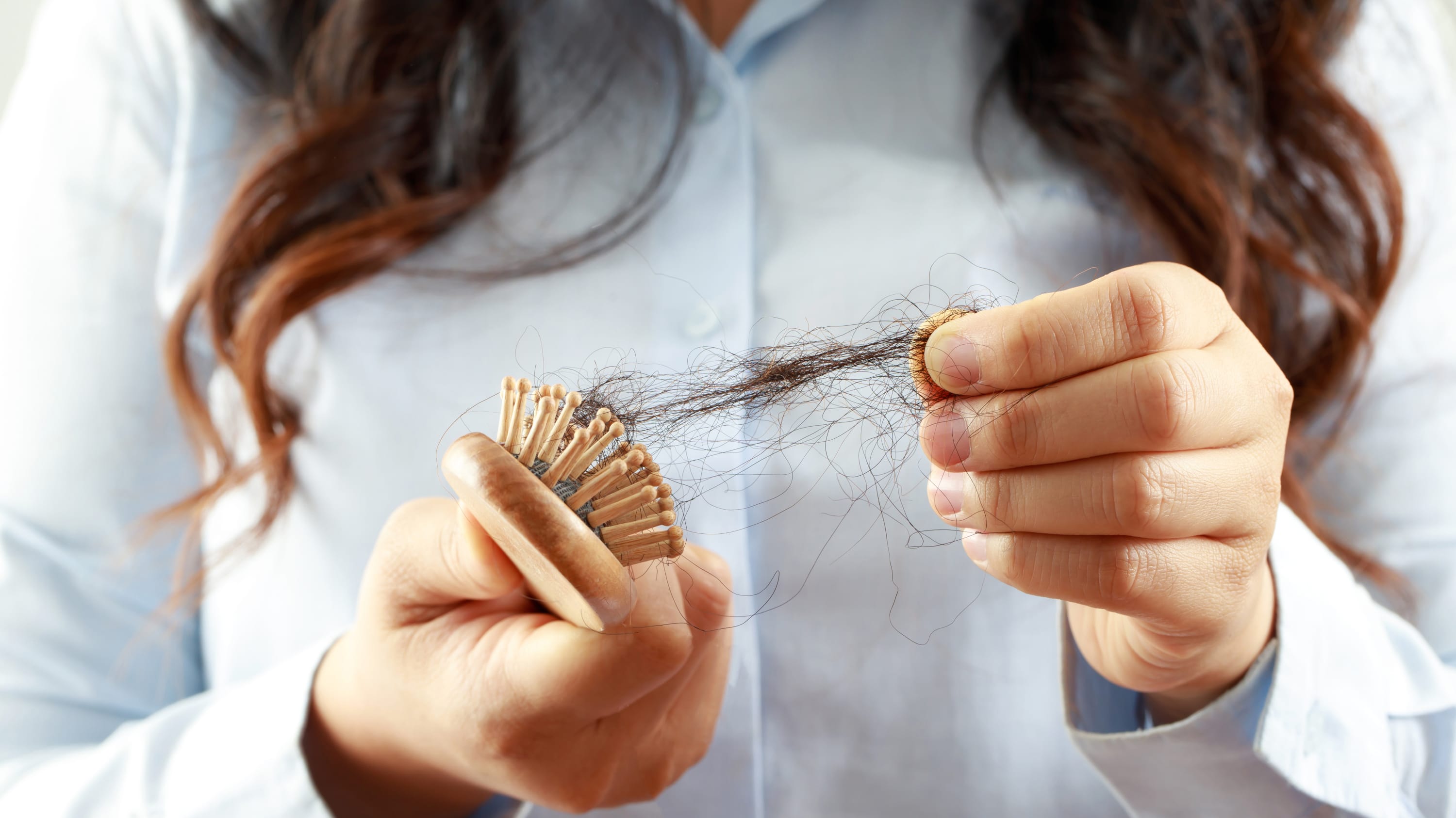 woman holding brush with hair on it, representing hair loss from alopecia areata