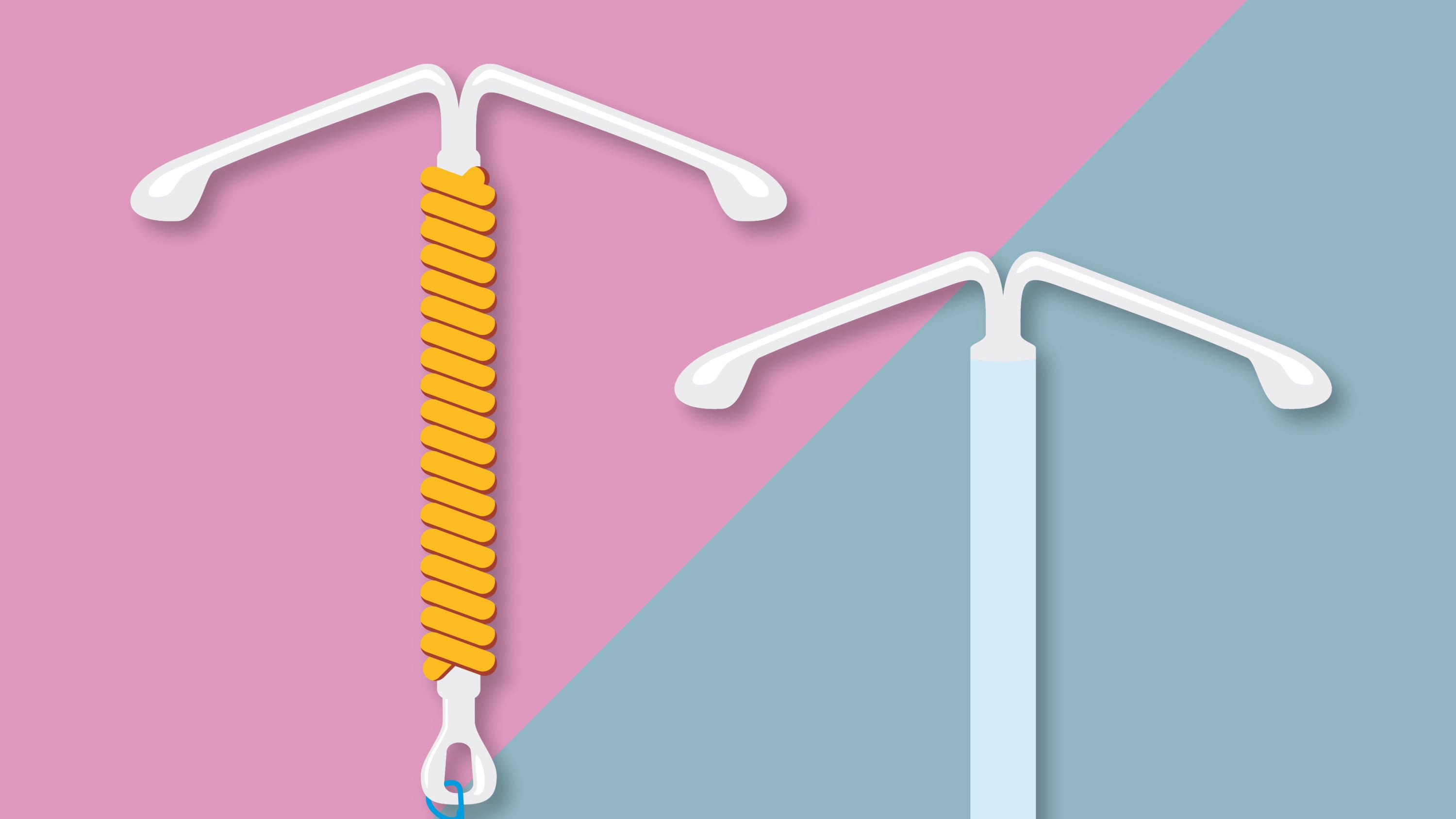 illustration of intrauterine devices (IUDs)