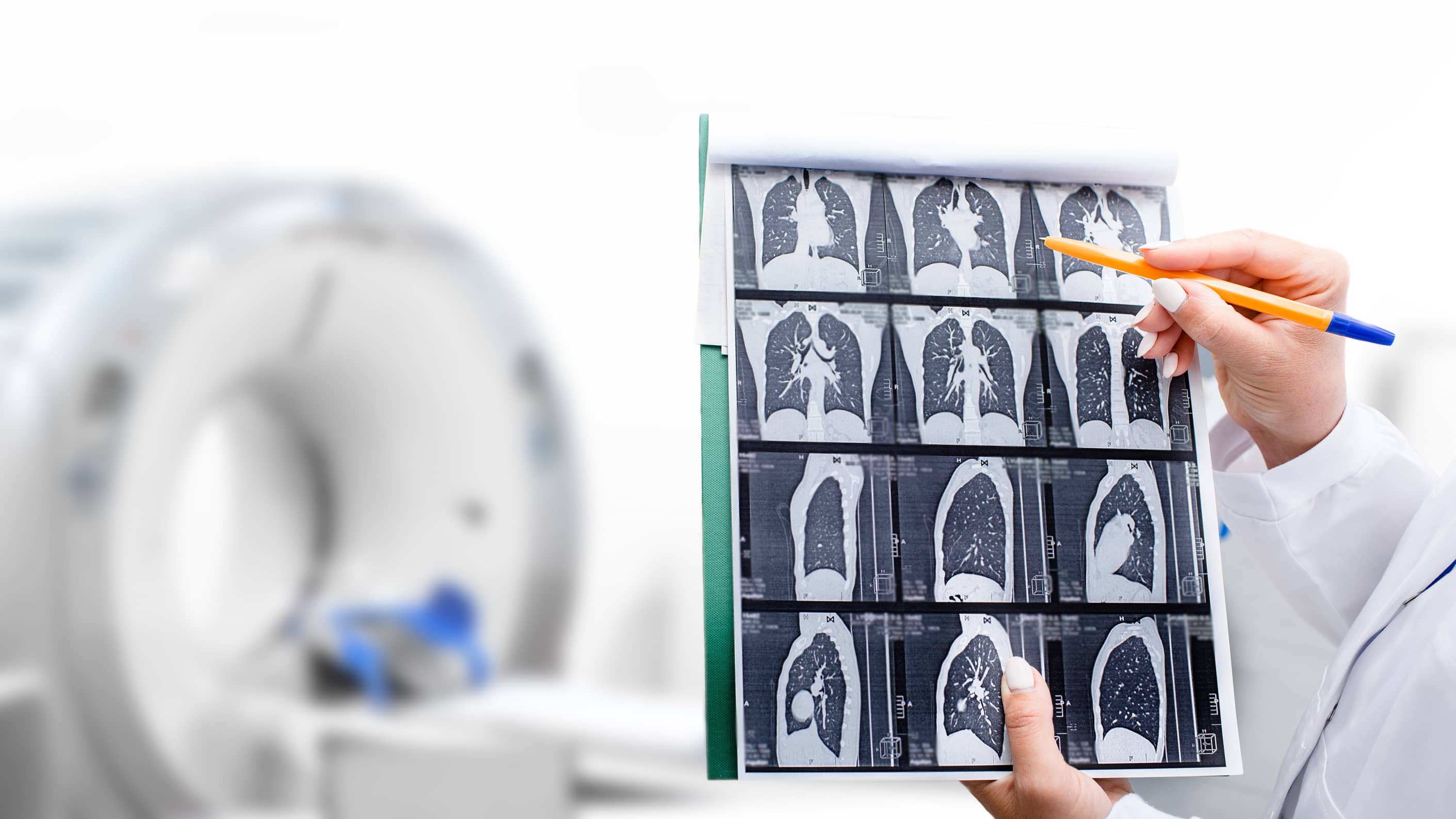 low-dose CT scan for lung cancer screening